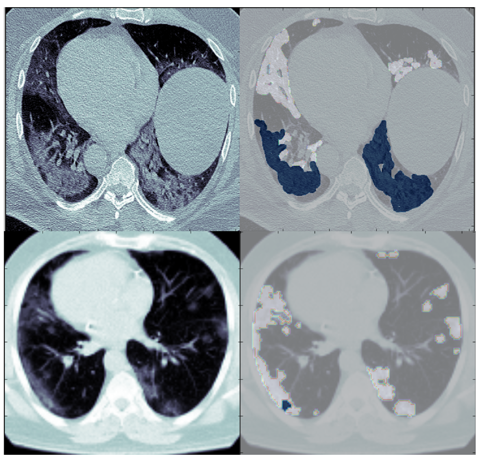 Diagnostics 13 01658 g001