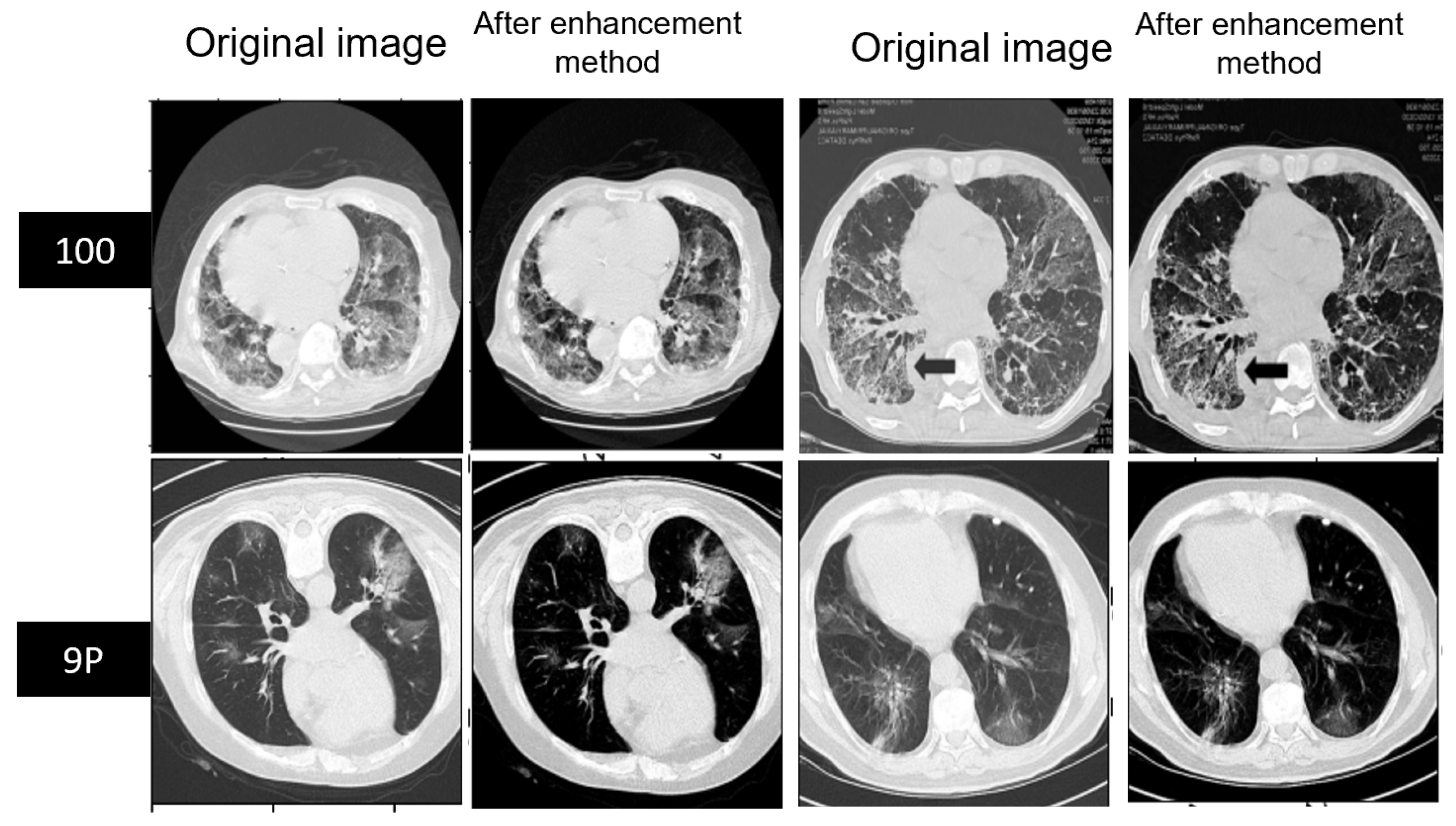 Diagnostics 13 01658 g007