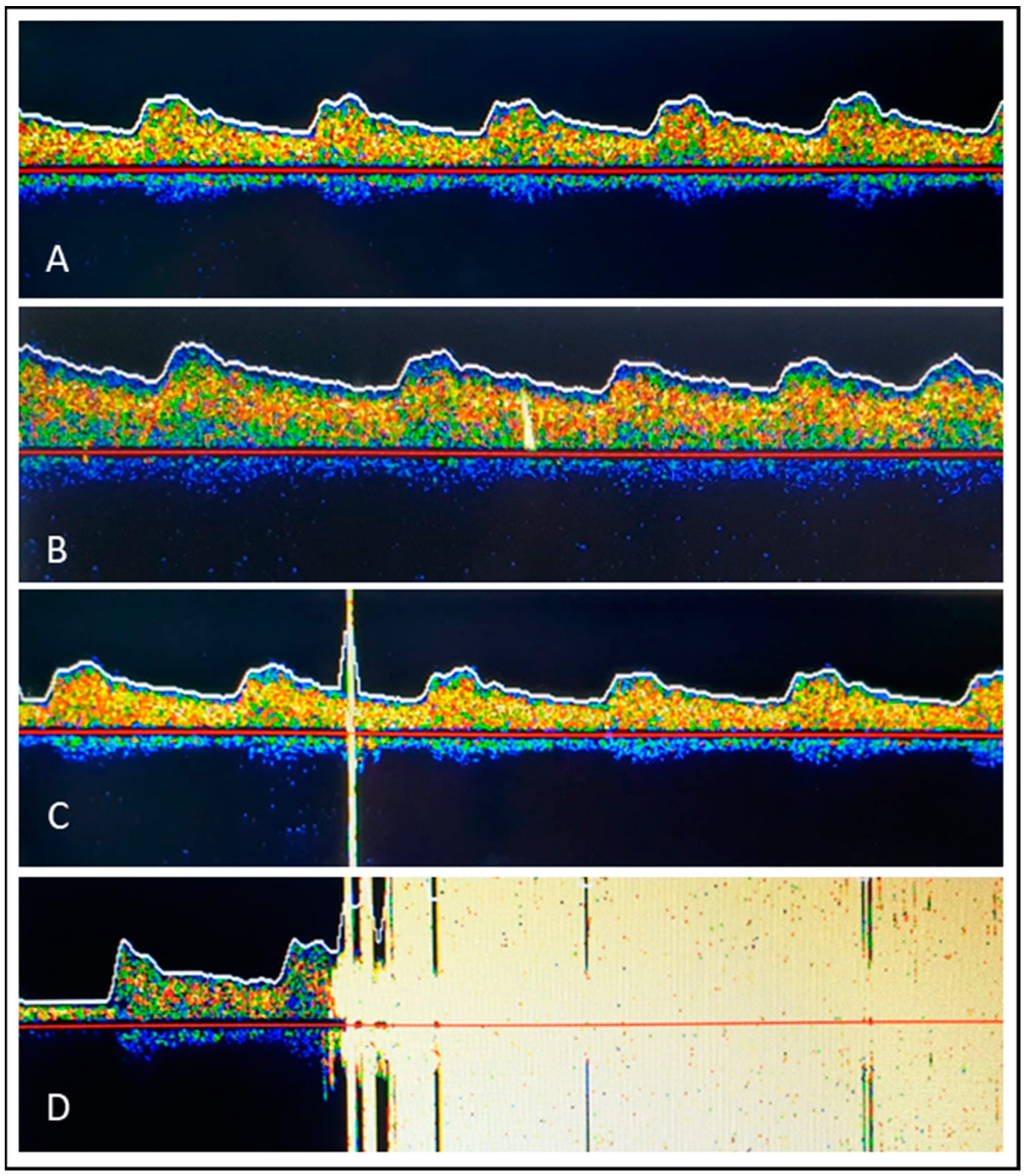 Diagnostics 13 01660 g003