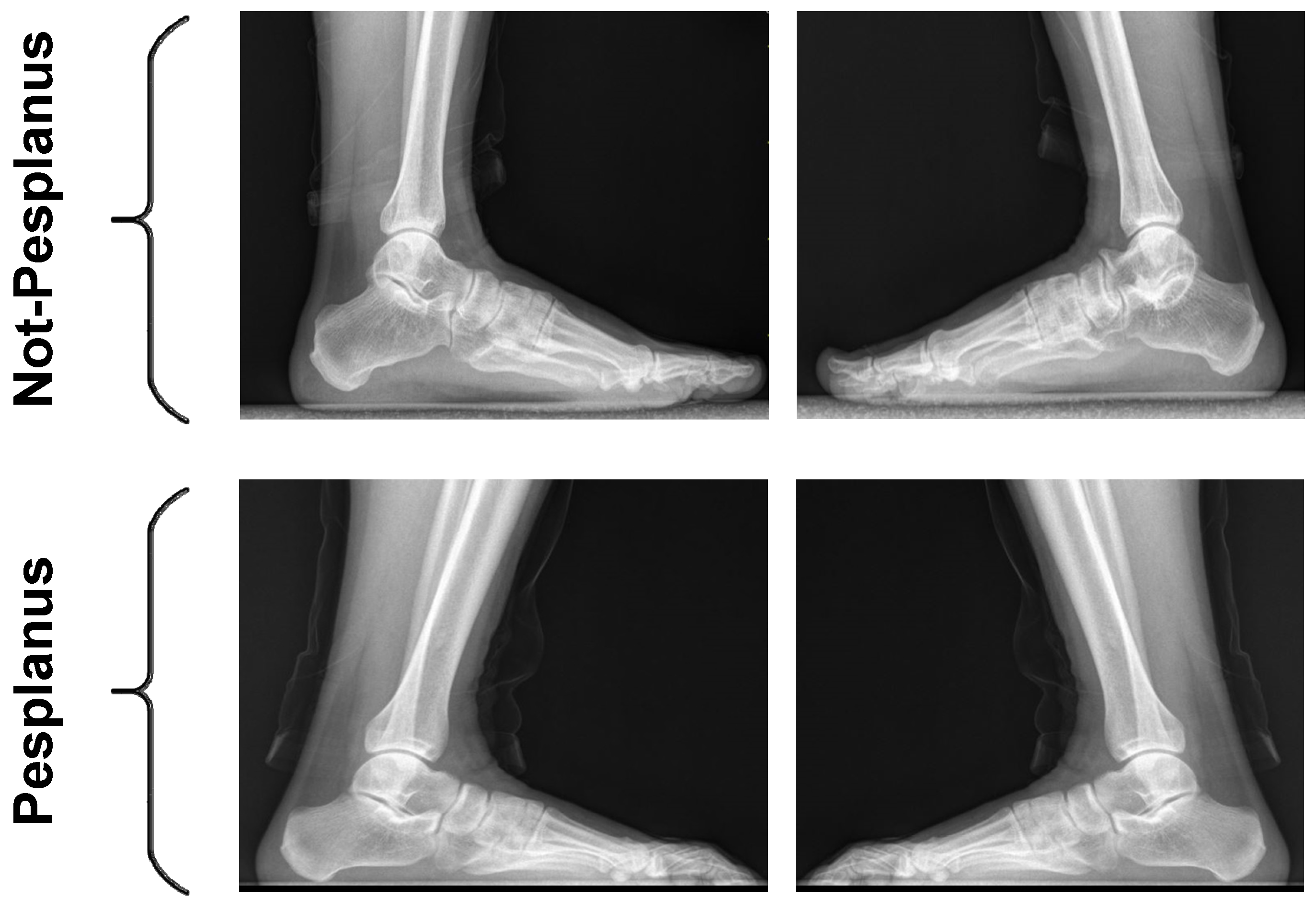 Diagnostics | Free Full-Text | A Novel Deep Transfer Learning-Based ...