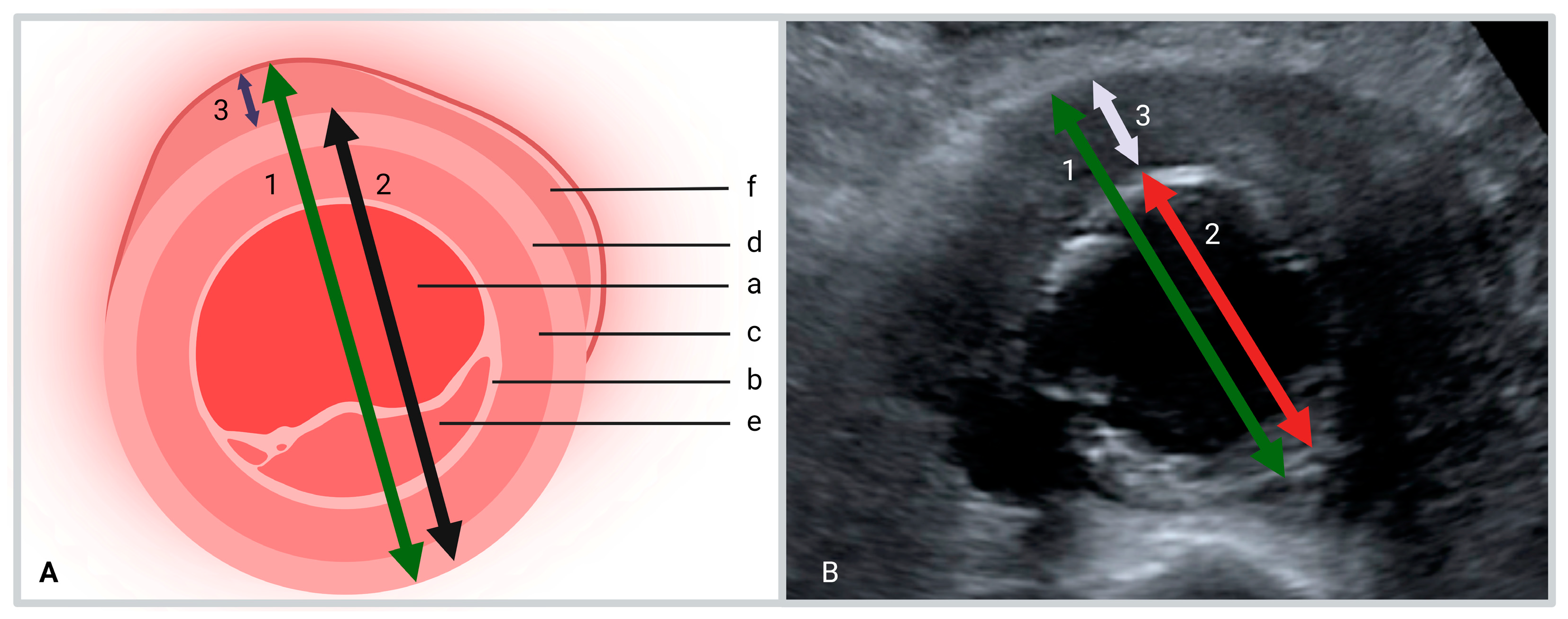 Diagnostics 13 01669 g001 Diagnostics 13 01669 g001