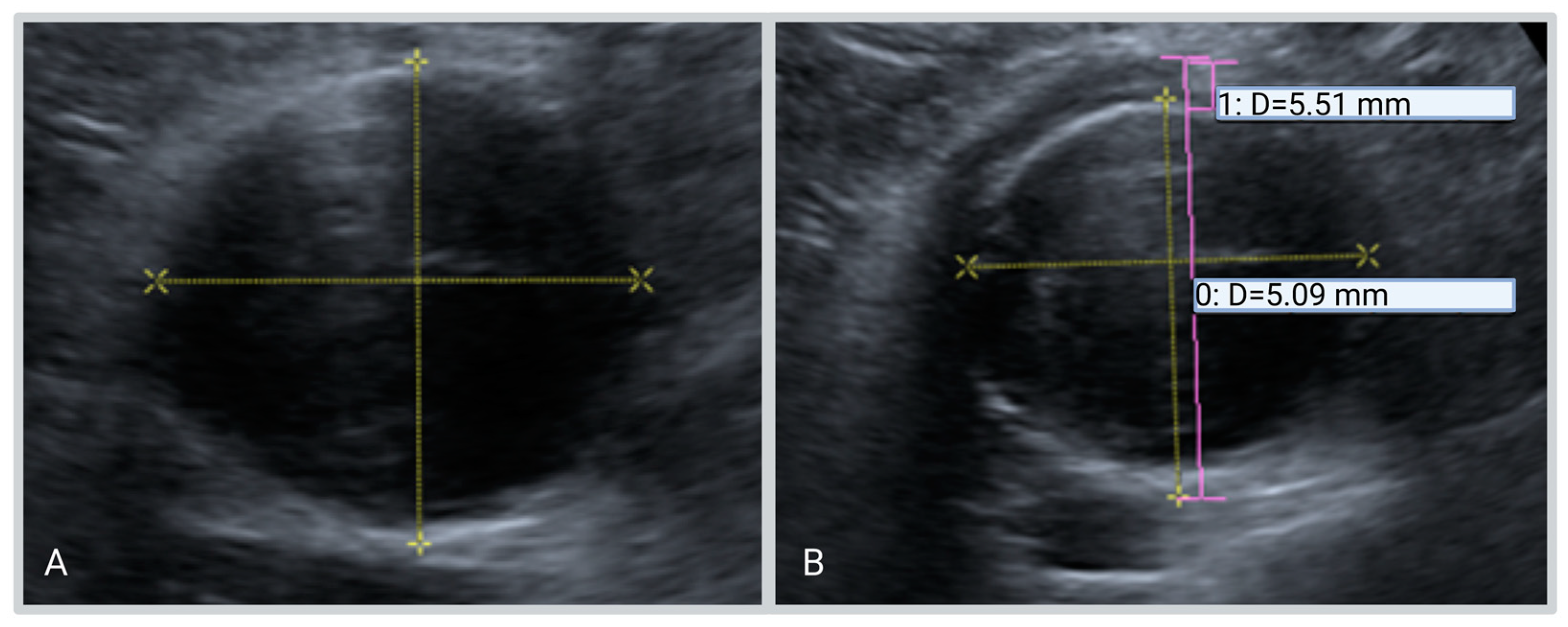 Diagnostics | Free Full-Text | Ultrasound for the Detection of ...