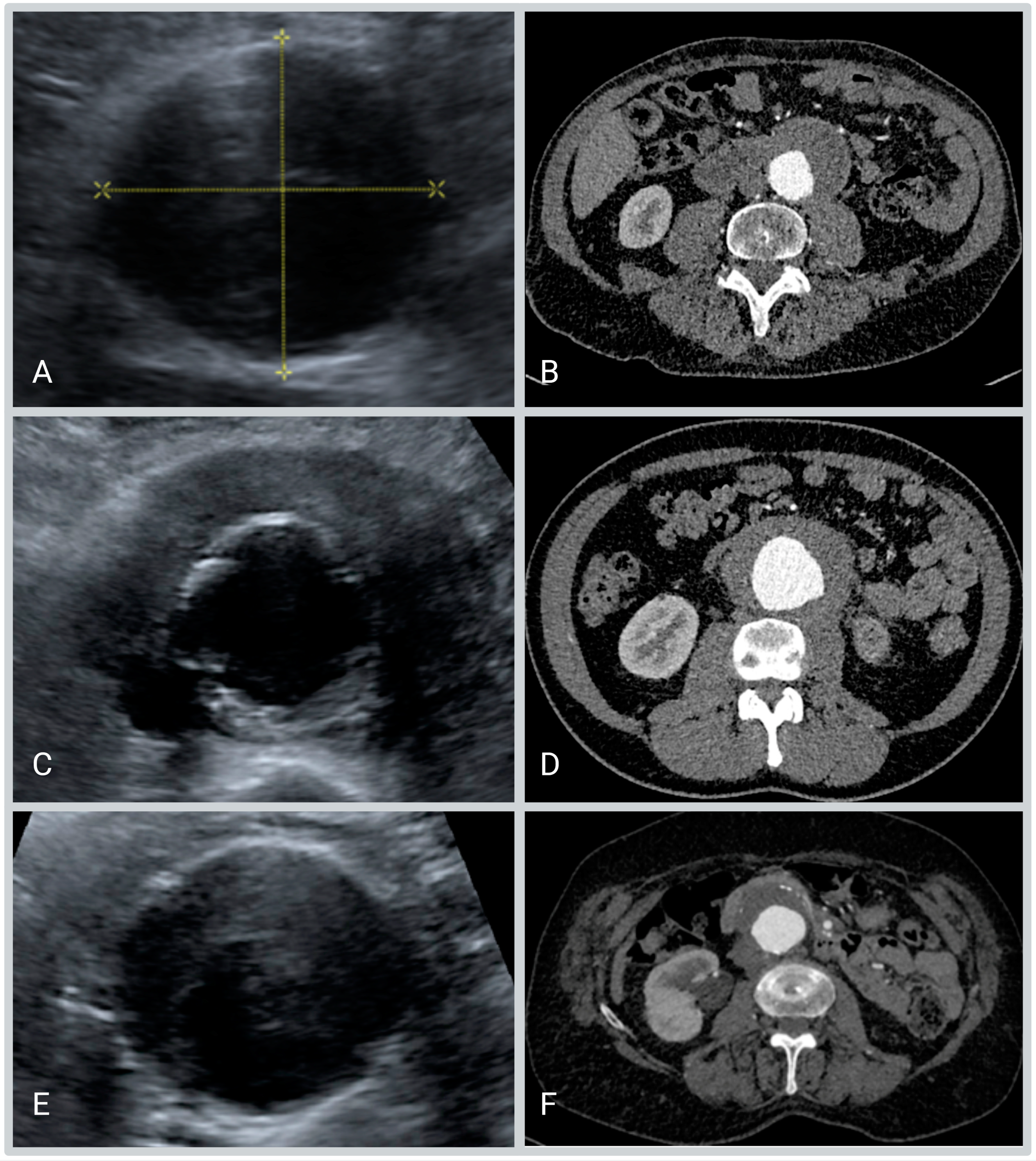 Diagnostics 13 01669 g003 Diagnostics 13 01669 g003