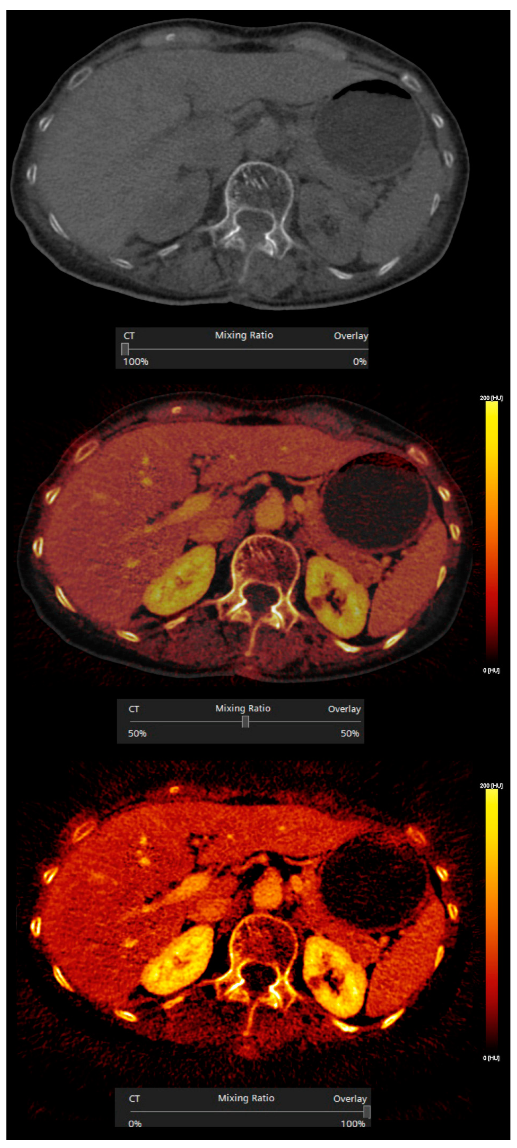 Diagnostics 13 01673 g002 Diagnostics 13 01673 g002