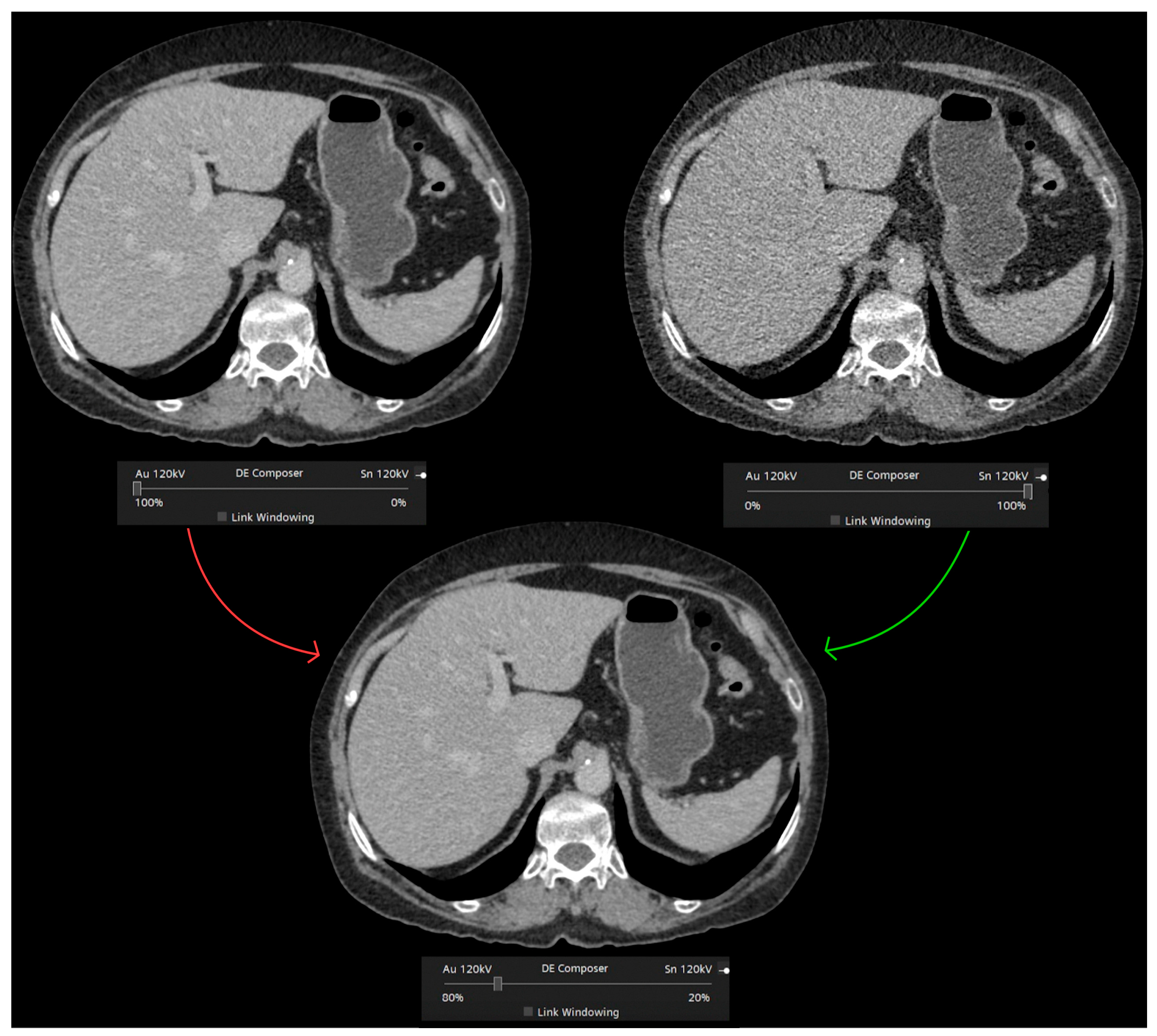 Diagnostics 13 01673 g003 Diagnostics 13 01673 g003