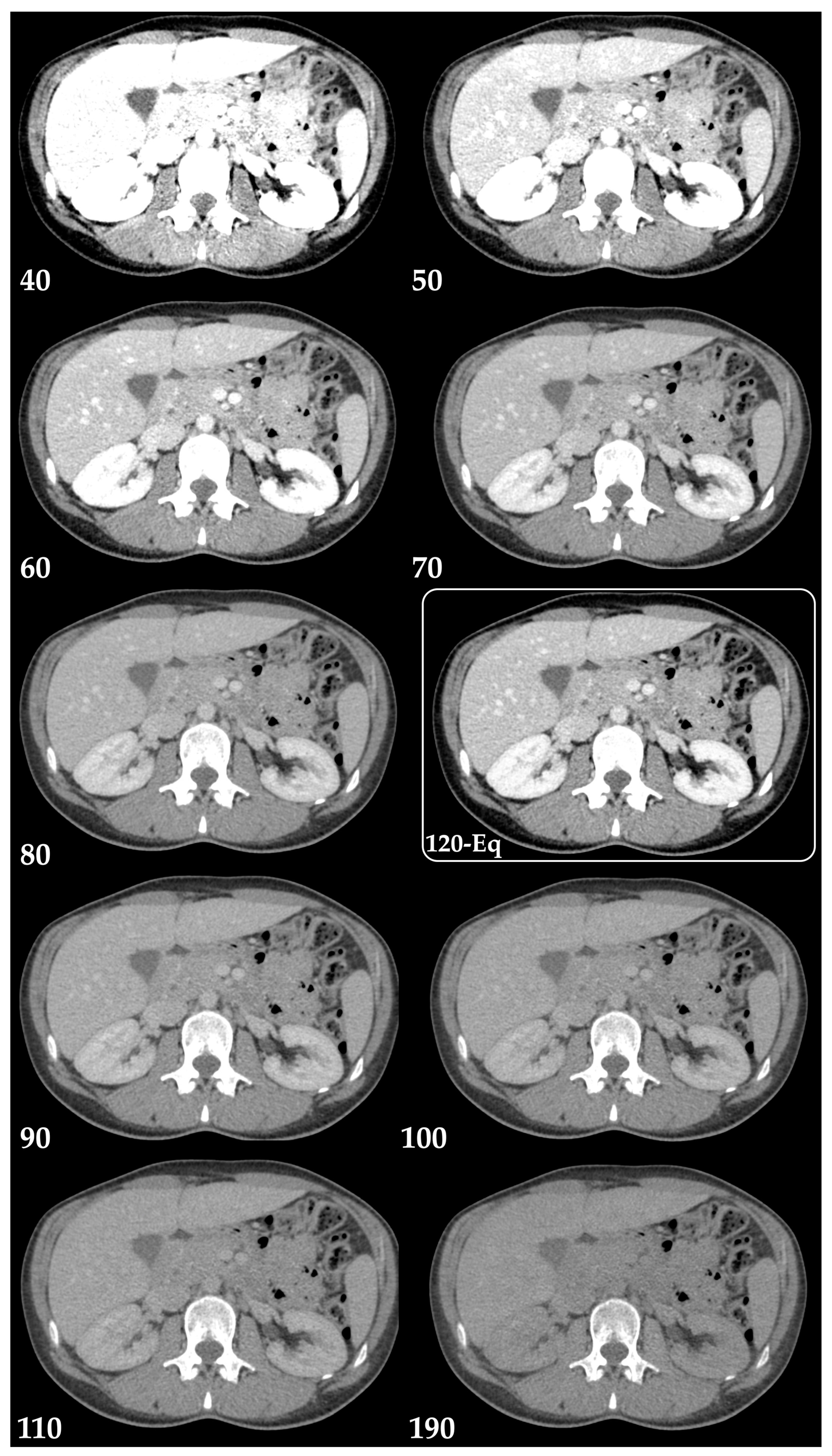 Diagnostics 13 01673 g004 Diagnostics 13 01673 g004