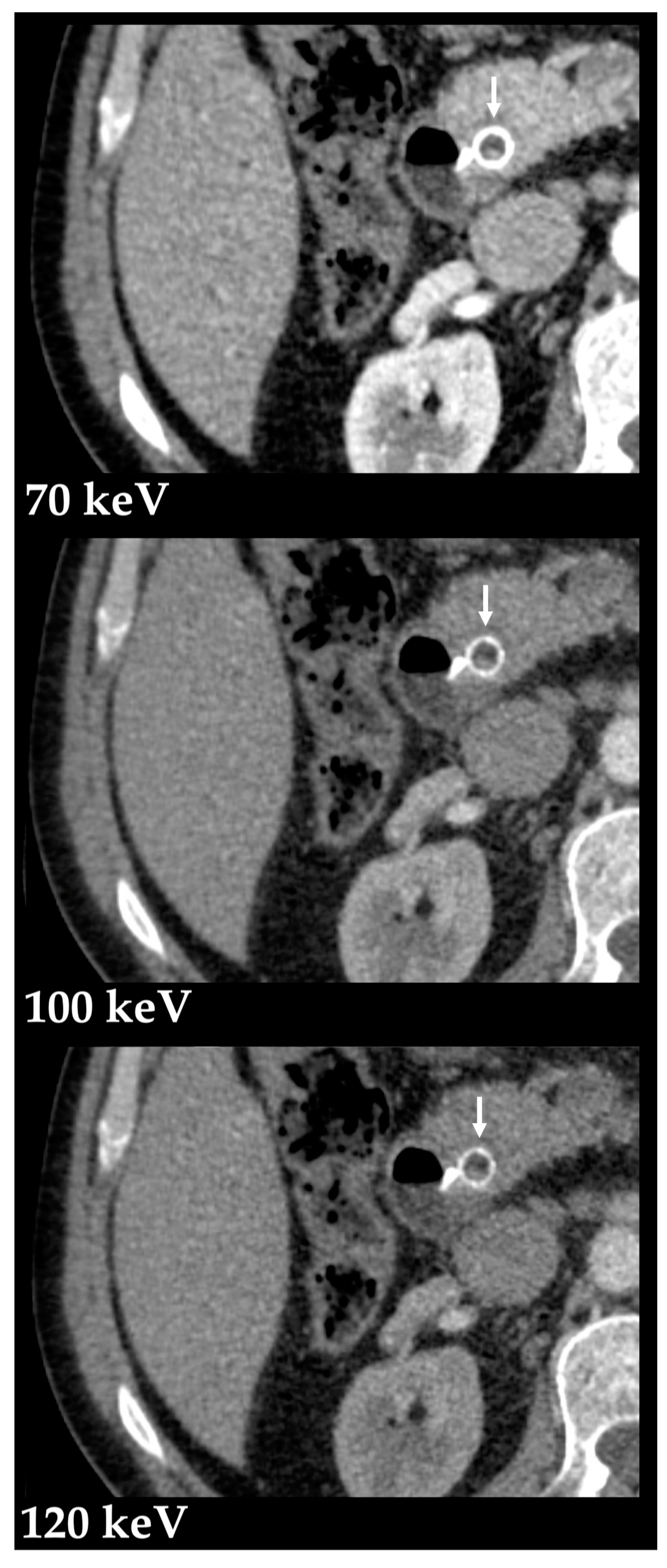 Diagnostics 13 01673 g005 Diagnostics 13 01673 g005