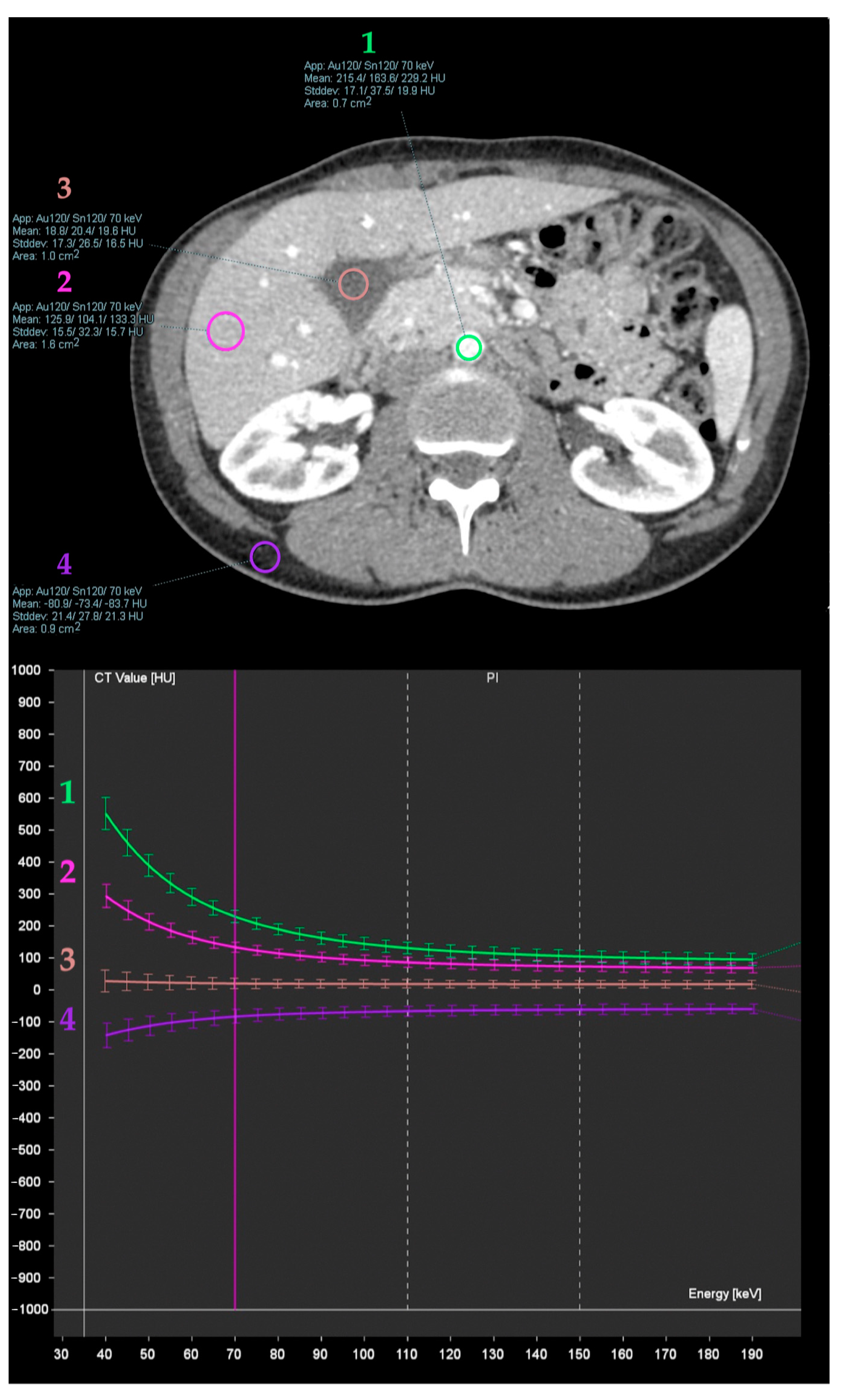 Diagnostics 13 01673 g006 Diagnostics 13 01673 g006
