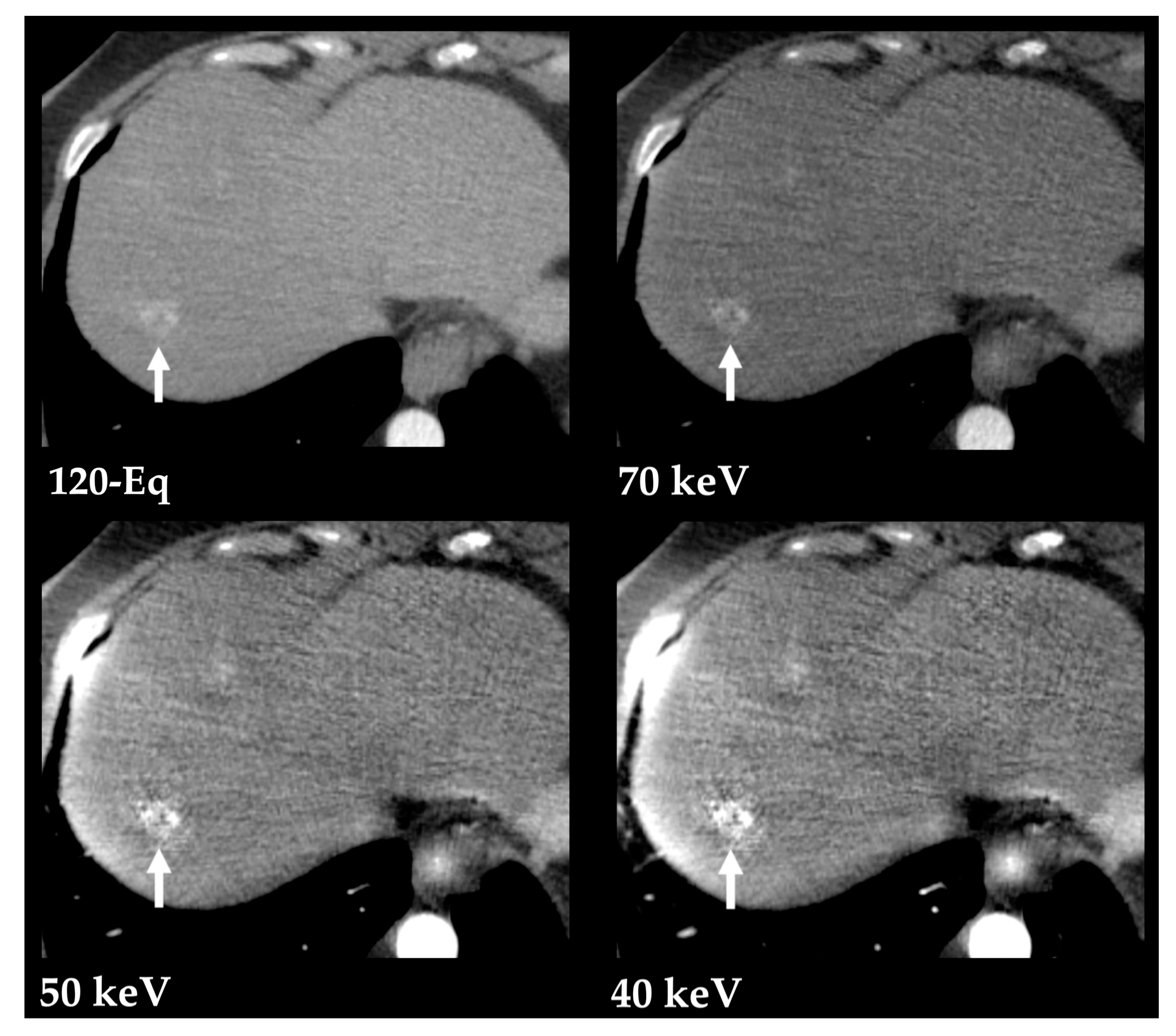 Diagnostics 13 01673 g007 Diagnostics 13 01673 g007