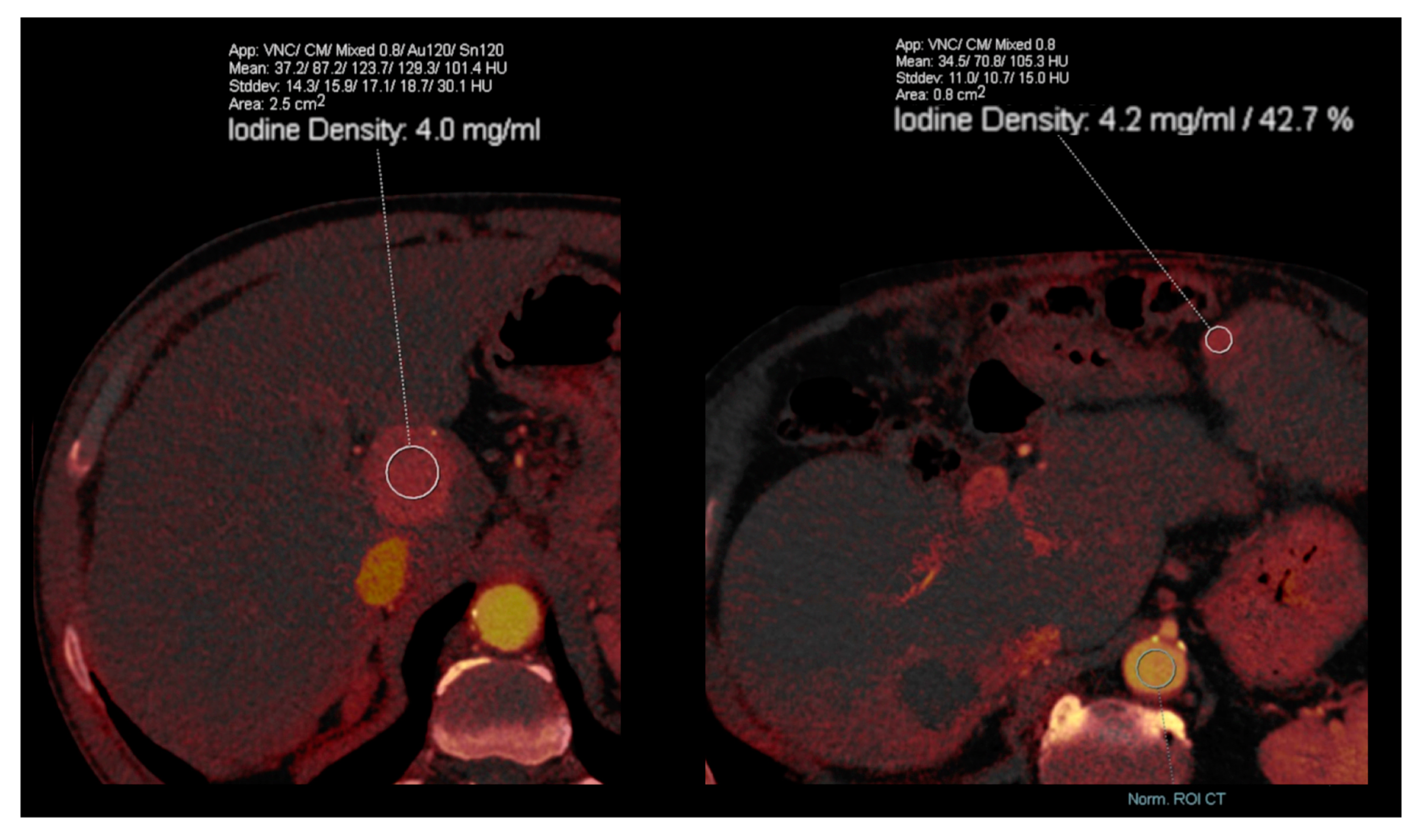 Diagnostics 13 01673 g009 Diagnostics 13 01673 g009