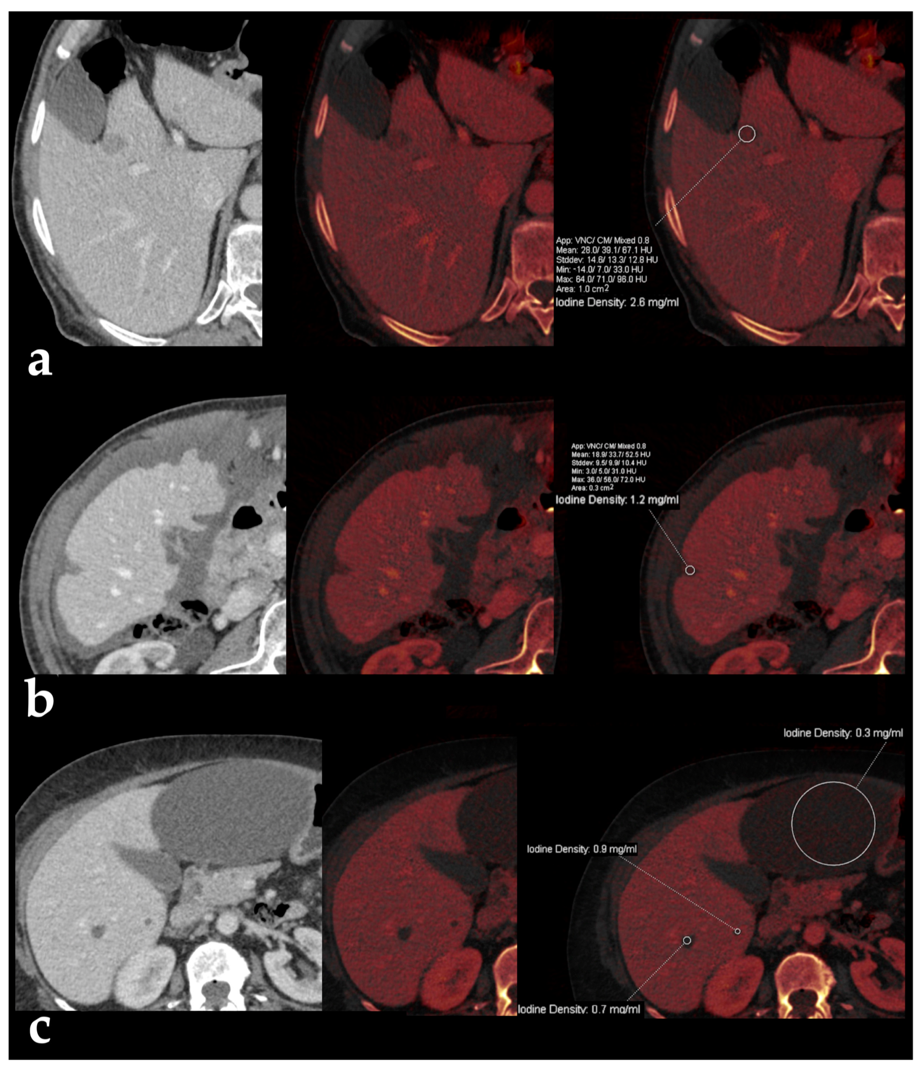 Diagnostics 13 01673 g011 Diagnostics 13 01673 g011