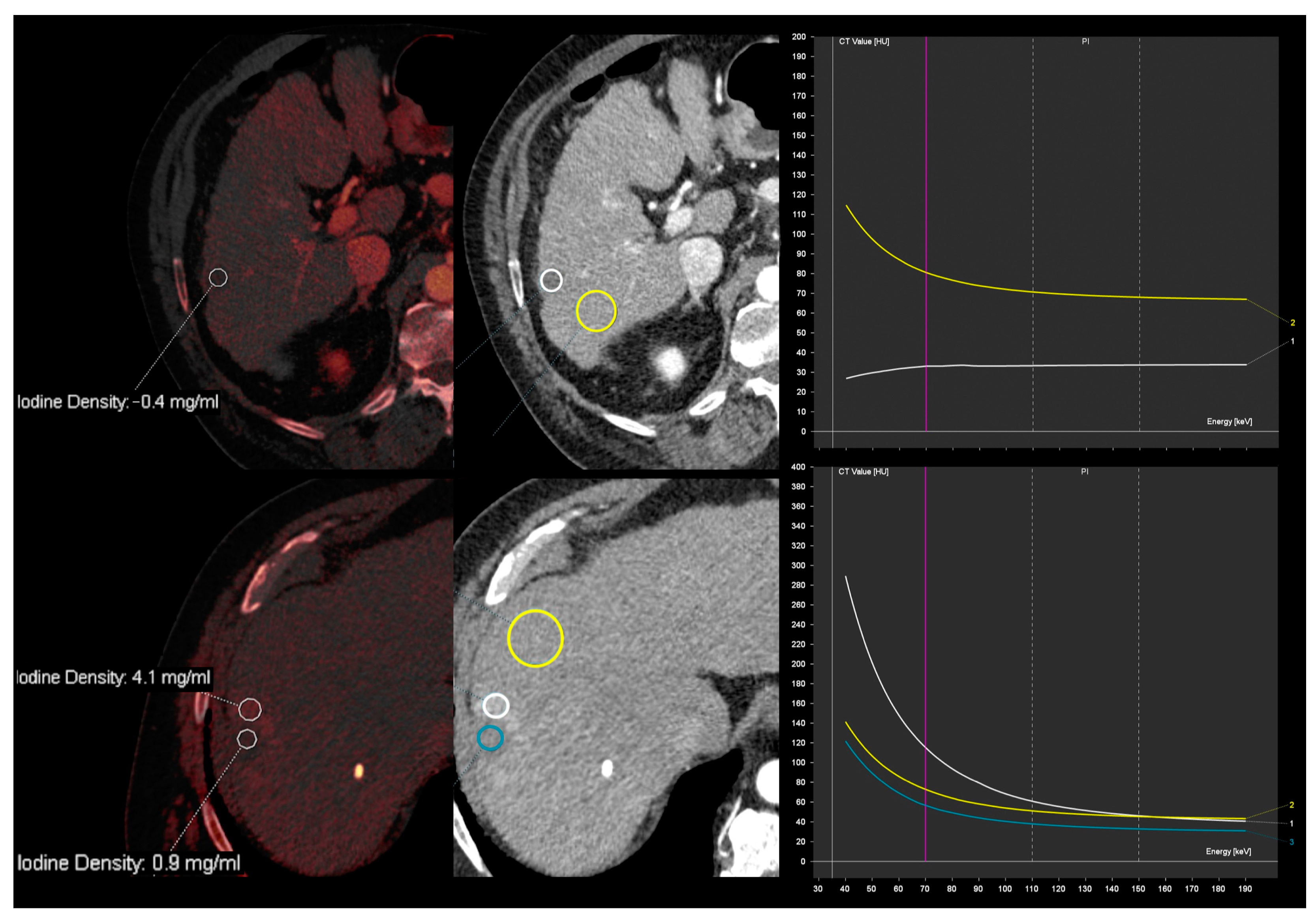 Diagnostics 13 01673 g013 Diagnostics 13 01673 g013