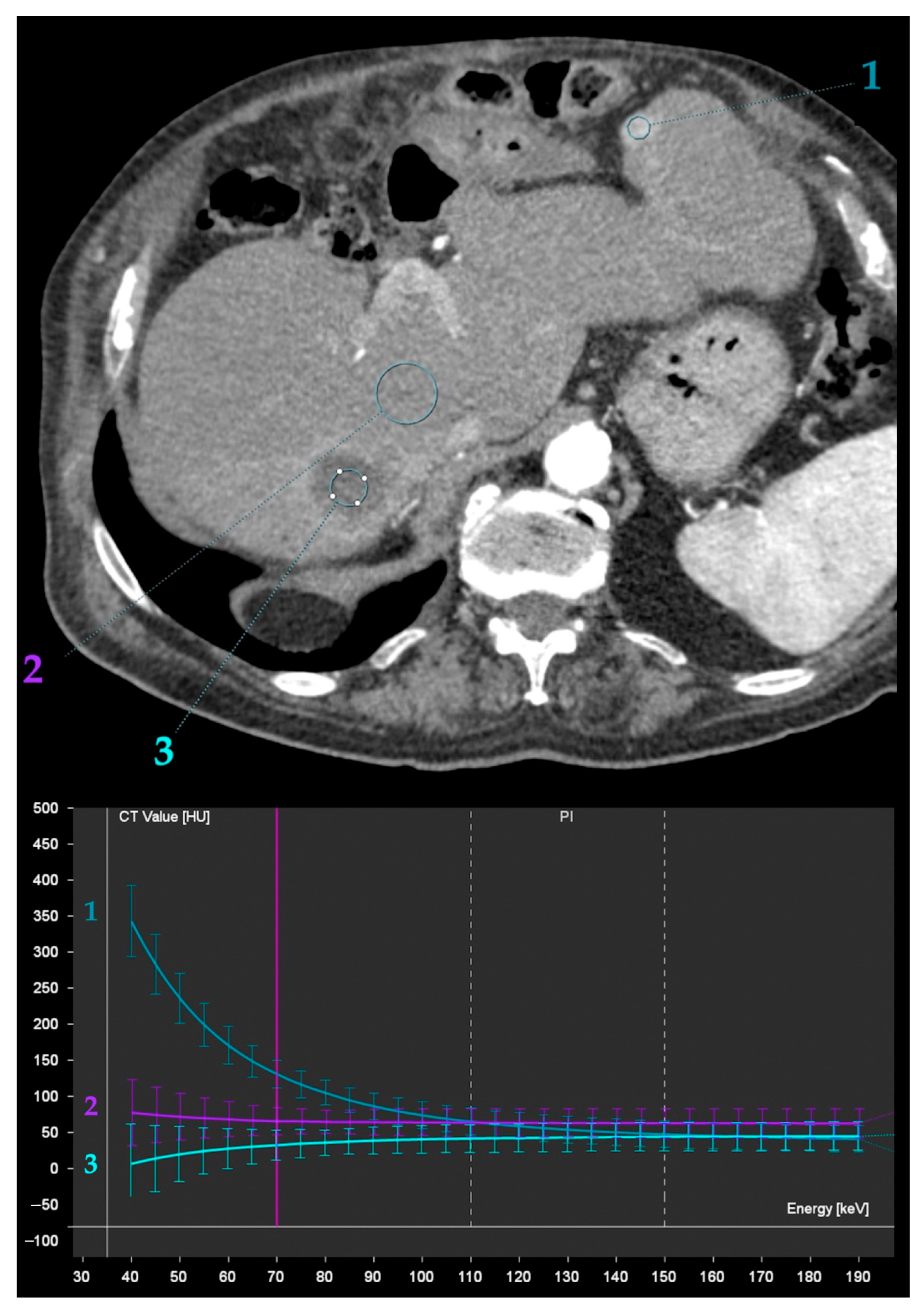Diagnostics 13 01673 g014 Diagnostics 13 01673 g014