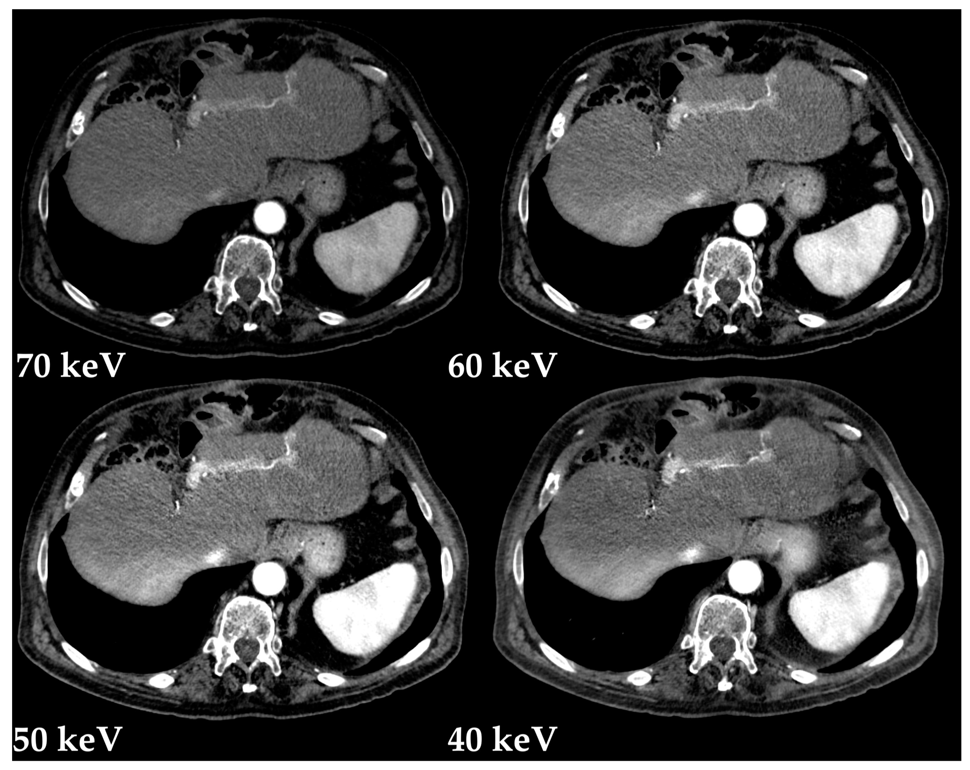 Diagnostics 13 01673 g017 Diagnostics 13 01673 g017