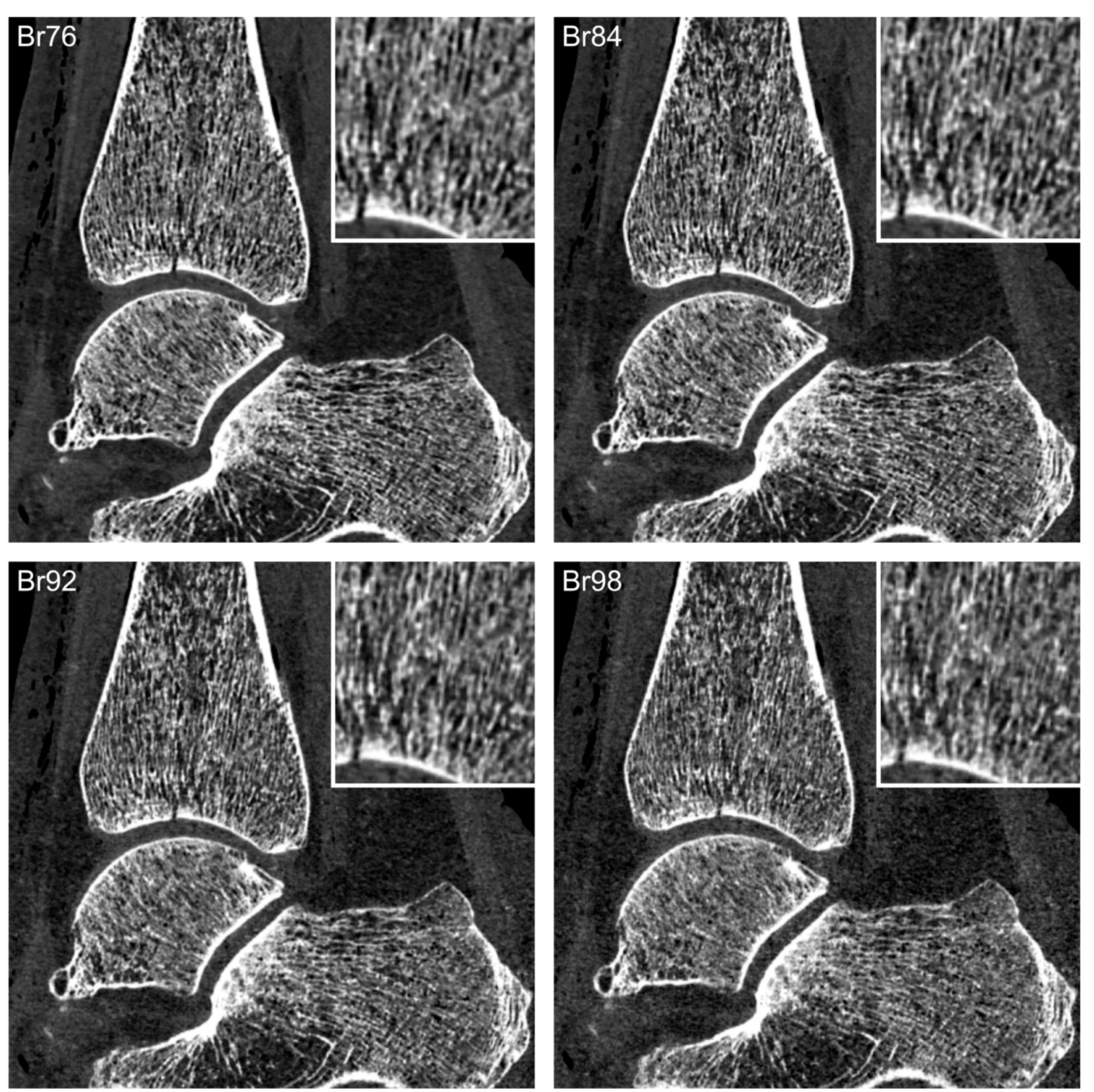 Diagnostics 13 01677 g003 Diagnostics 13 01677 g003