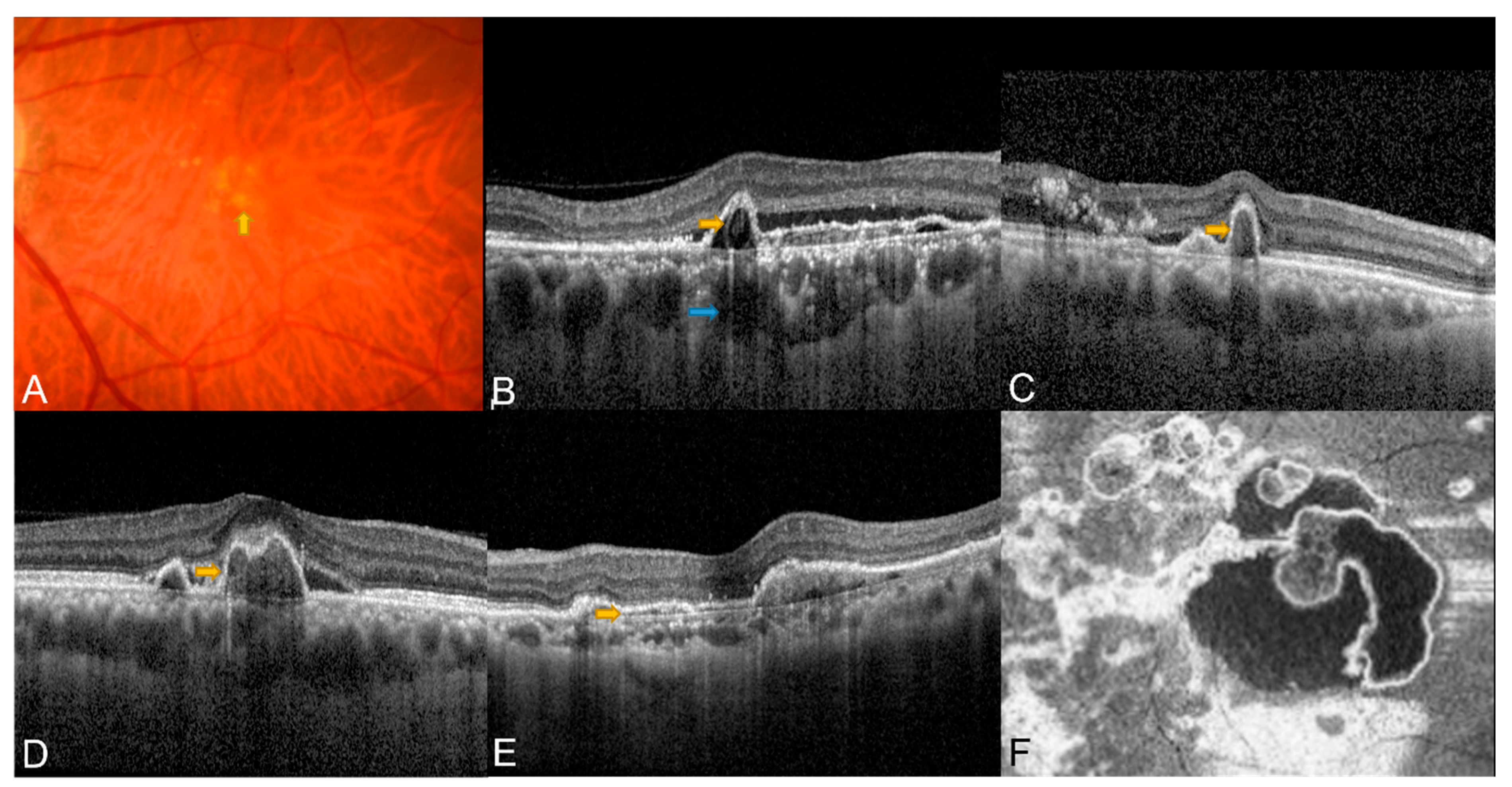 Diagnostics 13 01680 g001