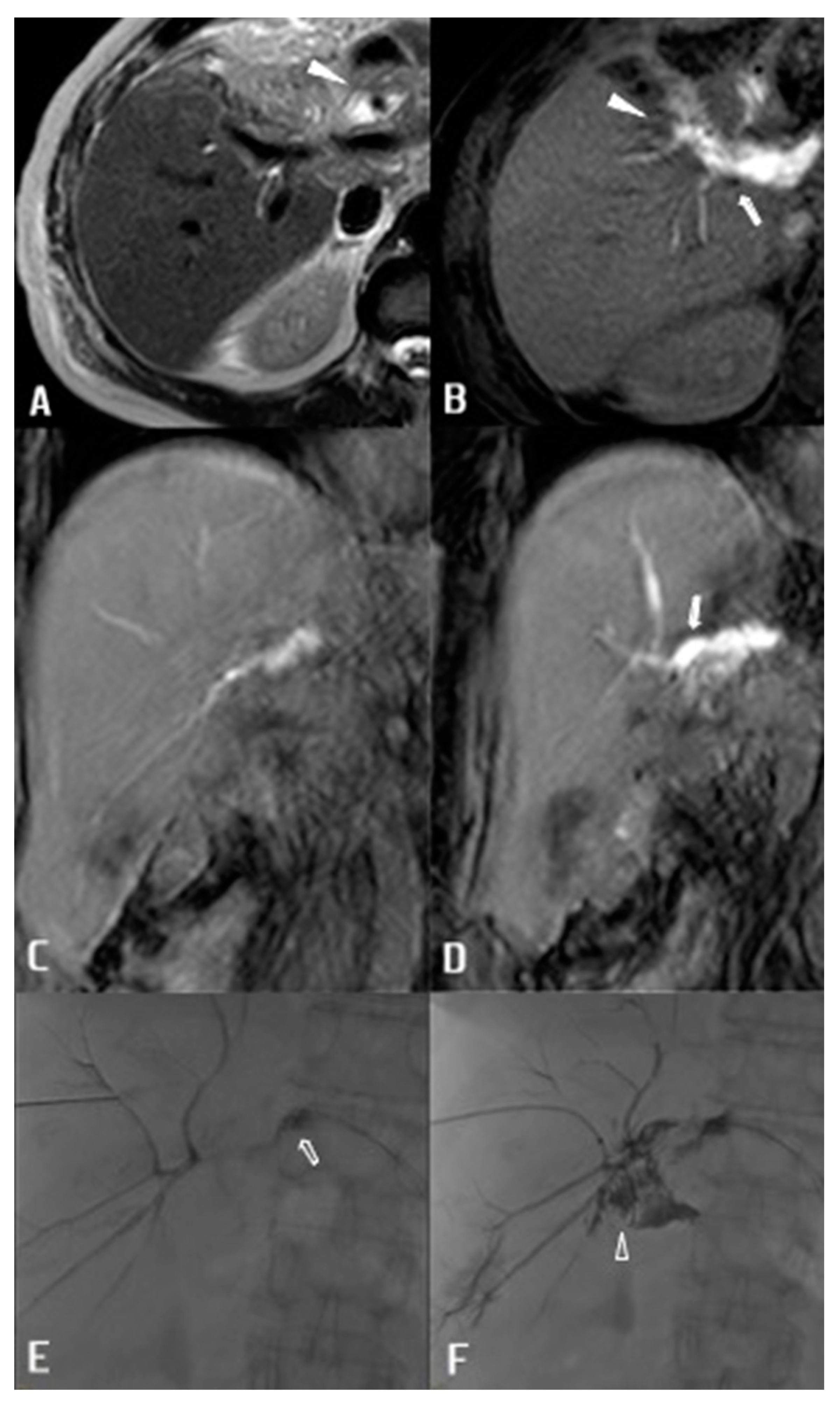 Diagnostics 13 01681 g003 Diagnostics 13 01681 g003