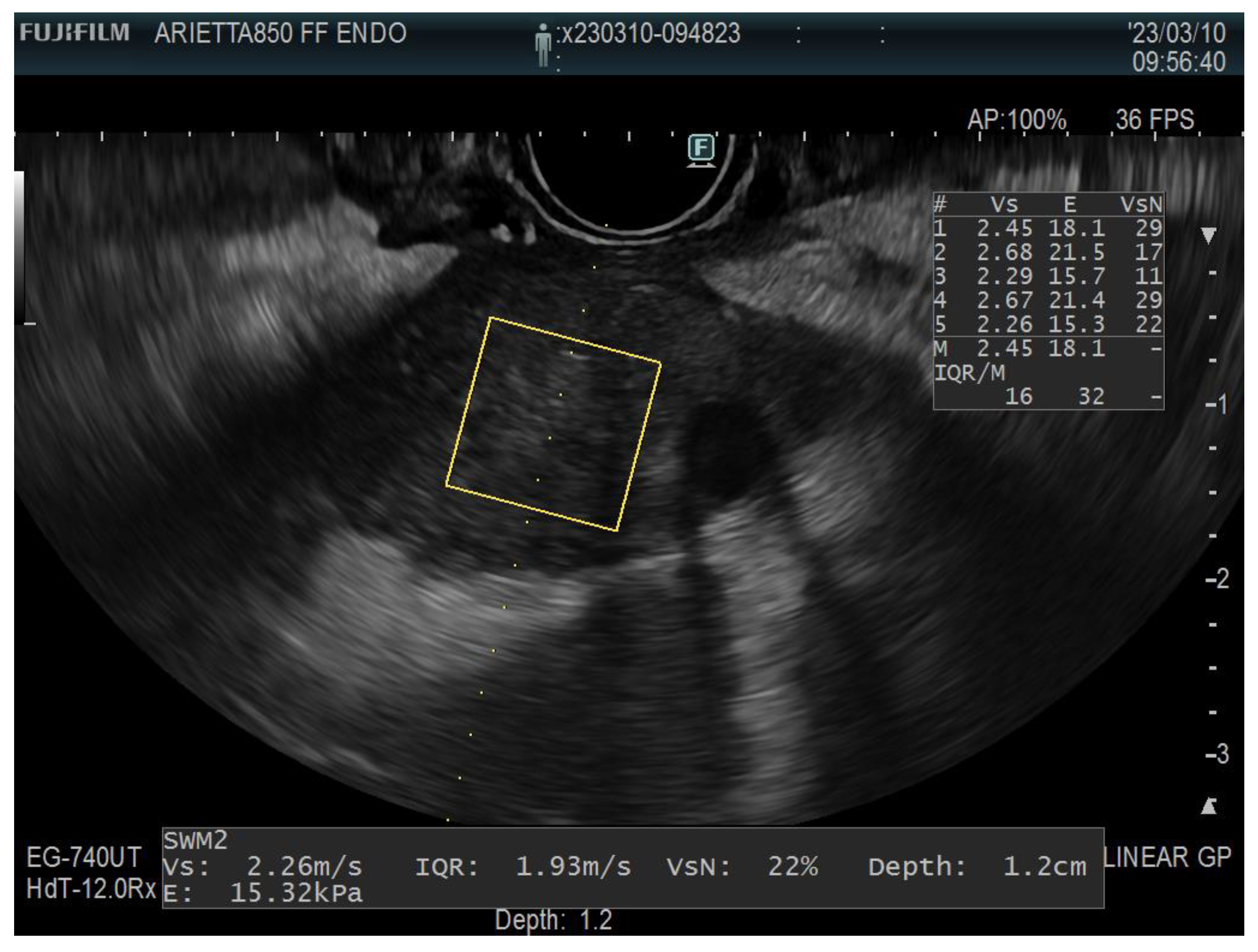 Diagnostics 13 01686 g006