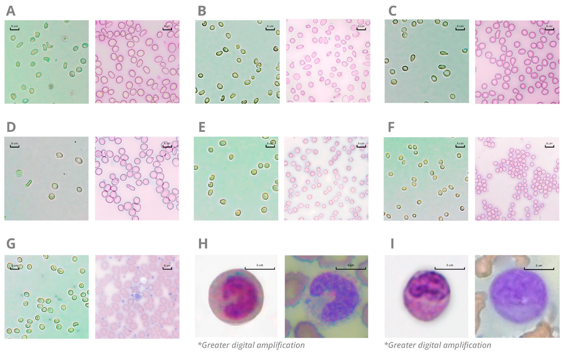 Diagnostics 13 01695 g005