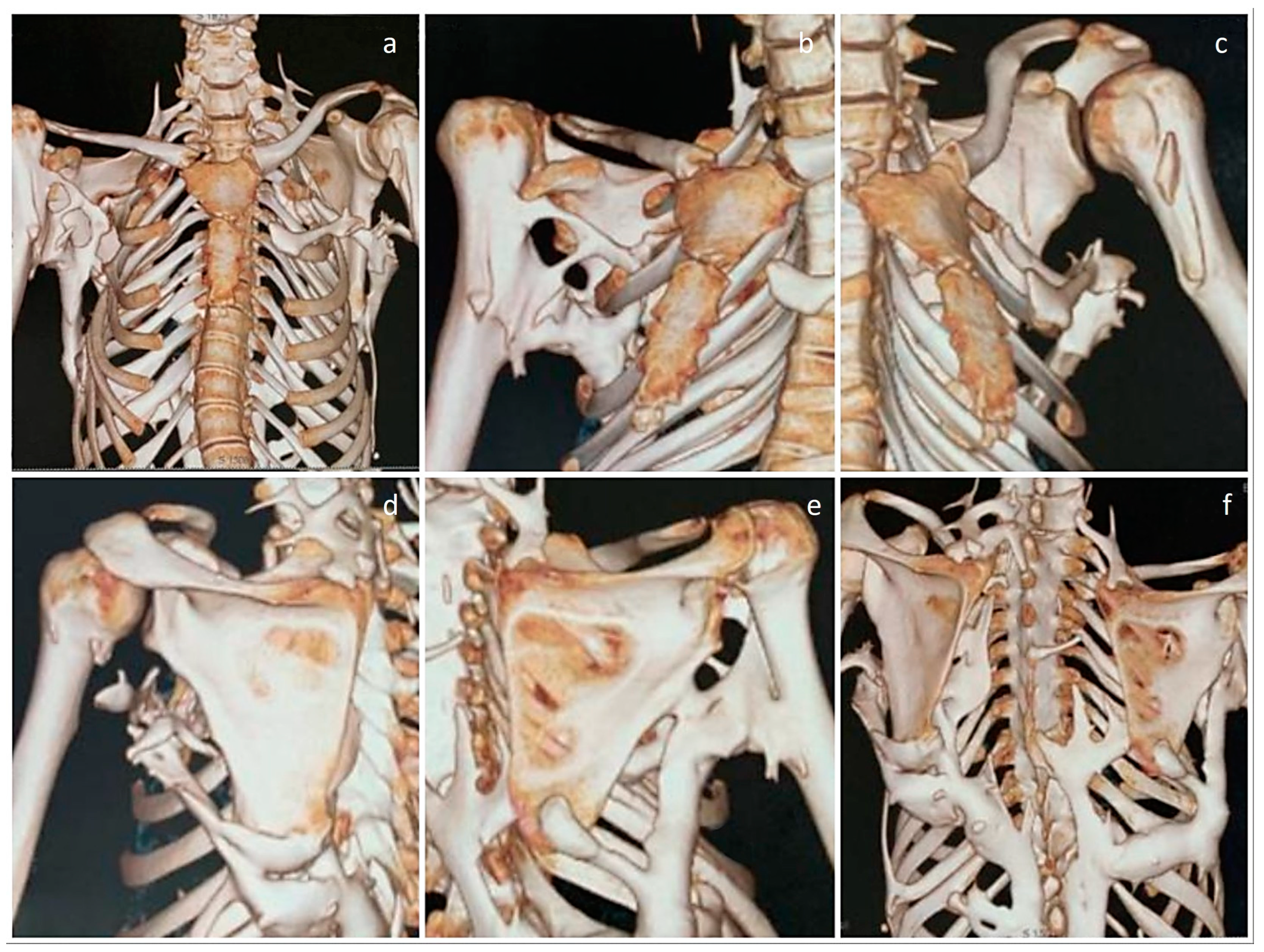 Diagnostics 13 01711 g003 Diagnostics 13 01711 g003