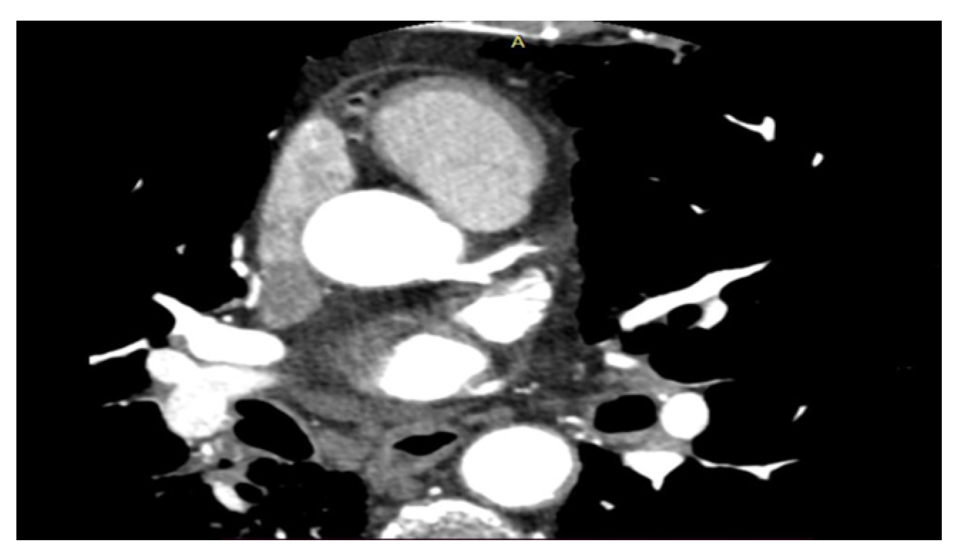 Diagnostics 13 01717 g001 Diagnostics 13 01717 g001