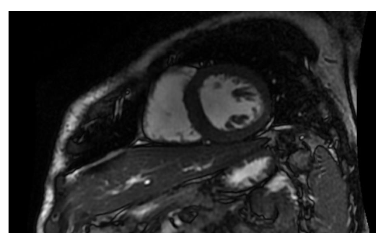 Diagnostics 13 01717 g002 Diagnostics 13 01717 g002