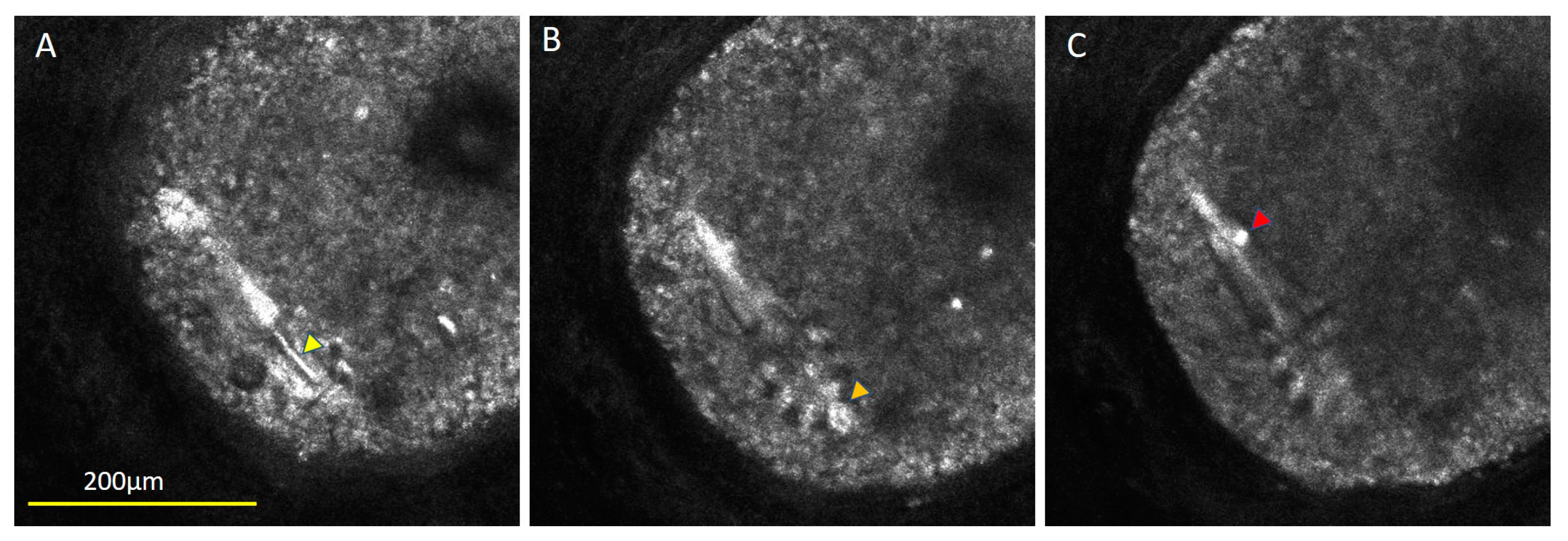 Diagnostics 13 01718 g001