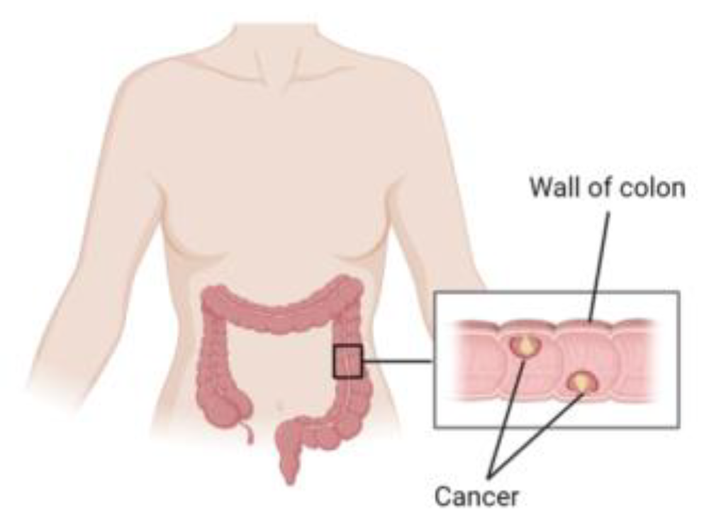 Diagnostics 13 01721 g001 Diagnostics 13 01721 g001