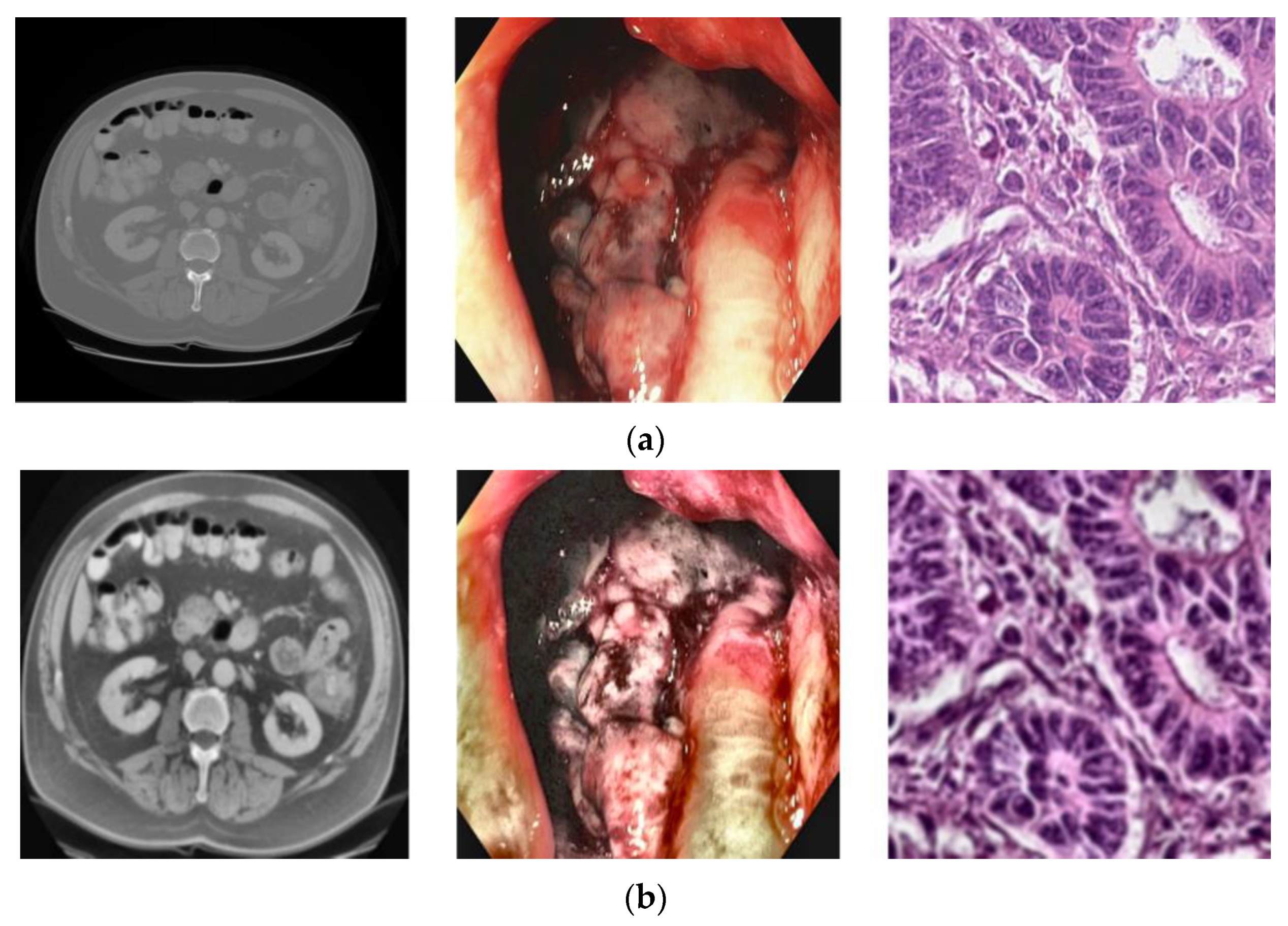 Diagnostics 13 01721 g002 Diagnostics 13 01721 g002