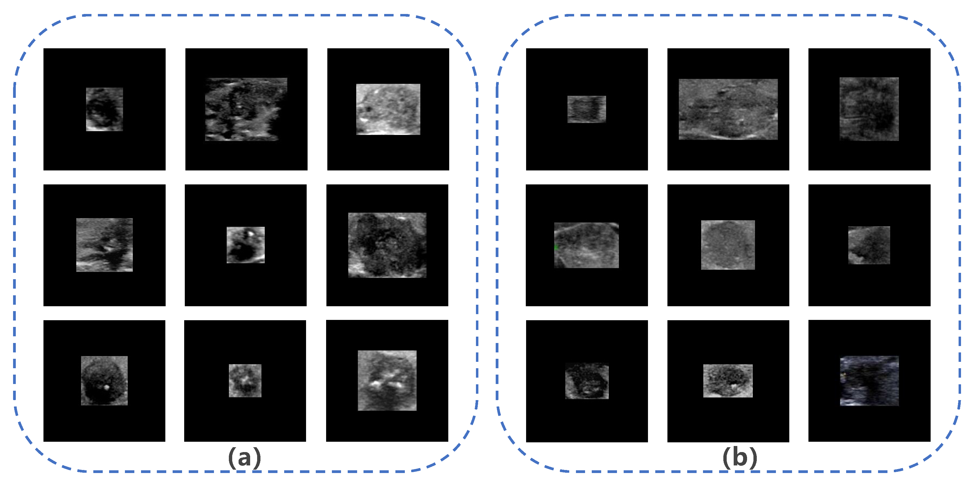 Diagnostics 13 01723 g004