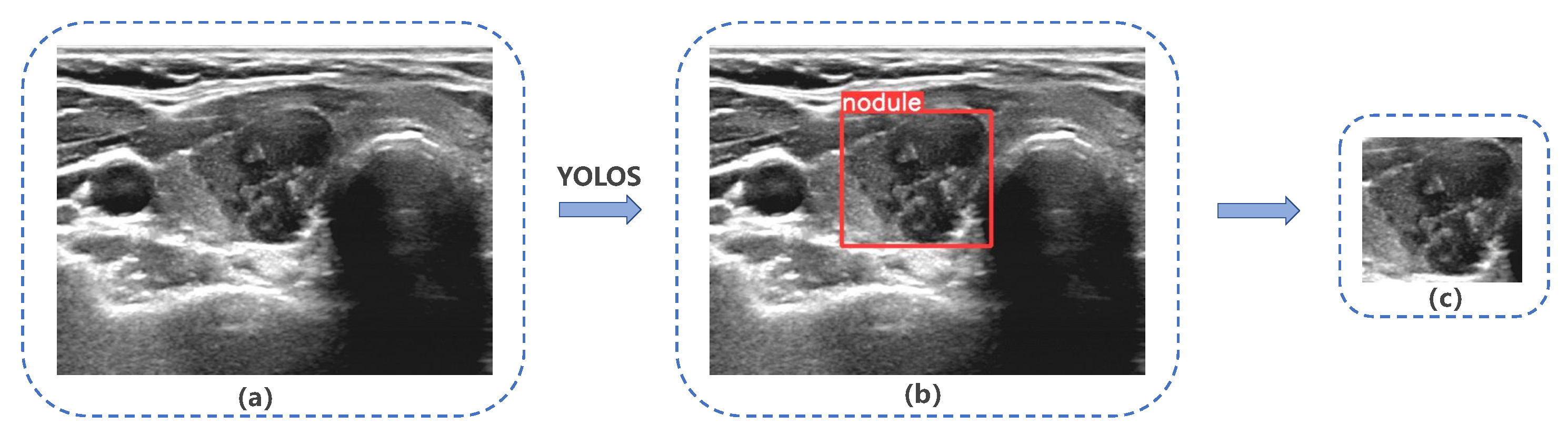 Diagnostics 13 01723 g005