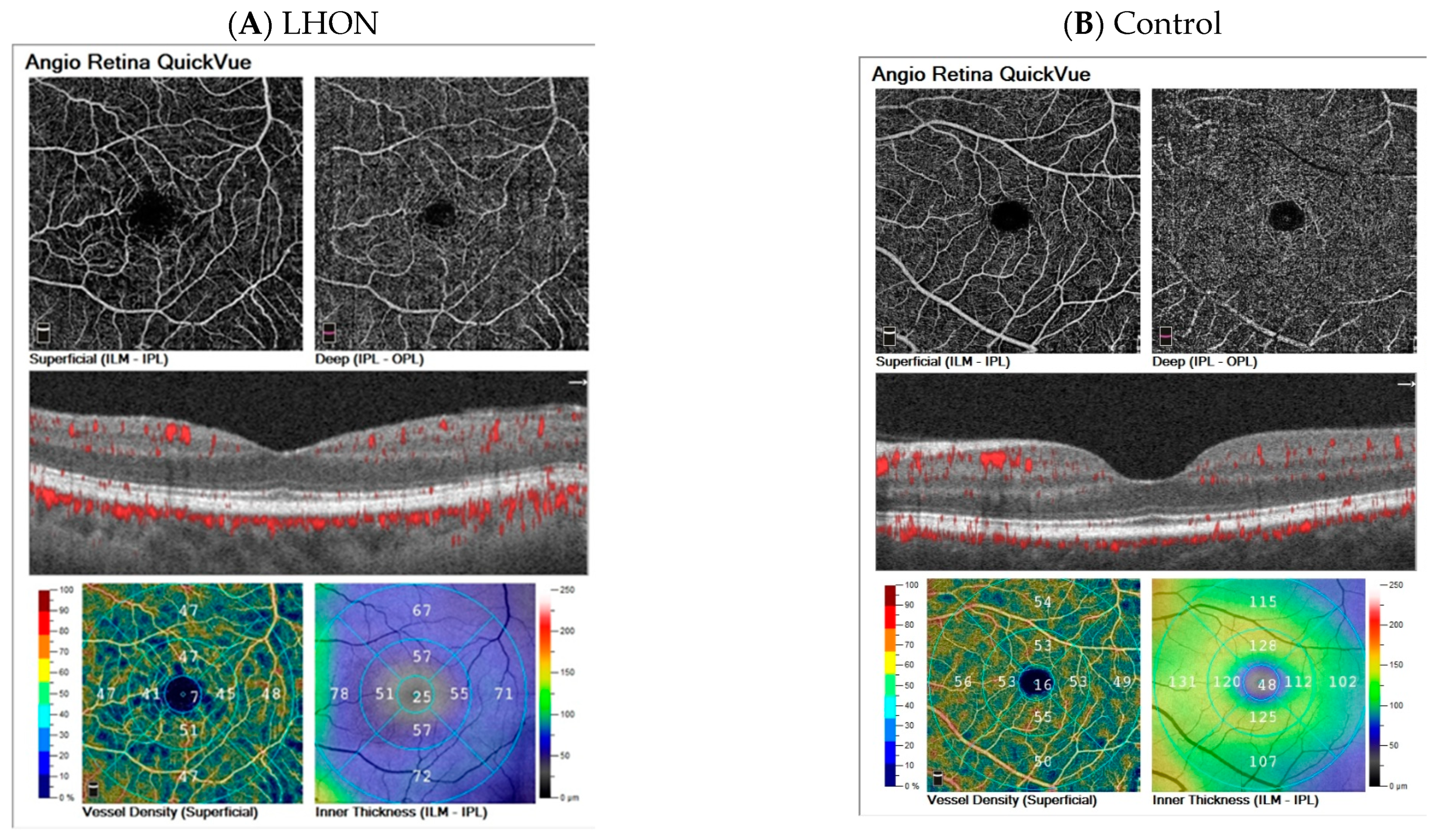 Diagnostics 13 01726 g005a