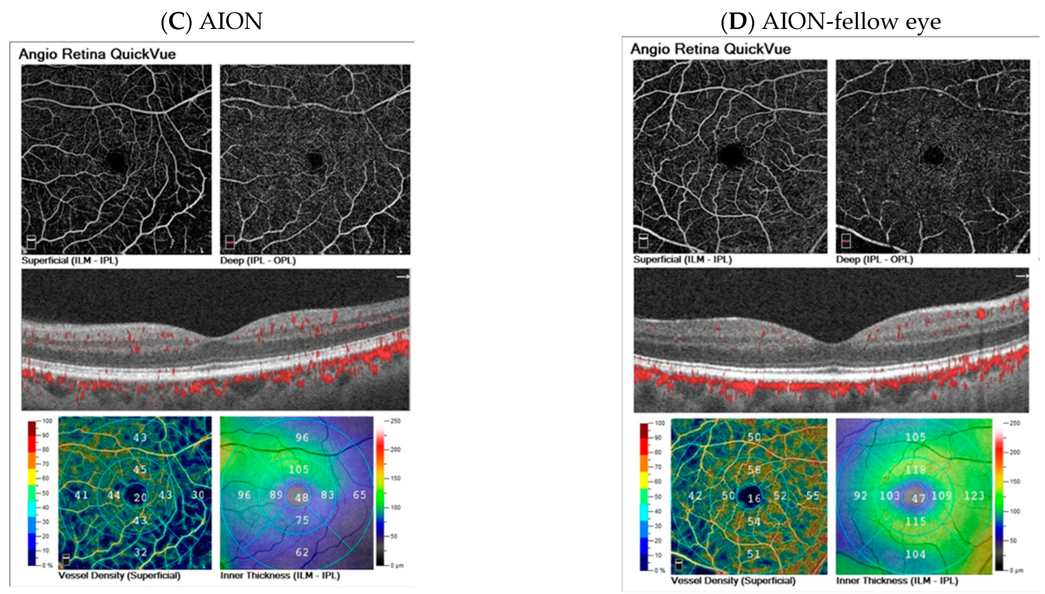 Diagnostics 13 01726 g005b