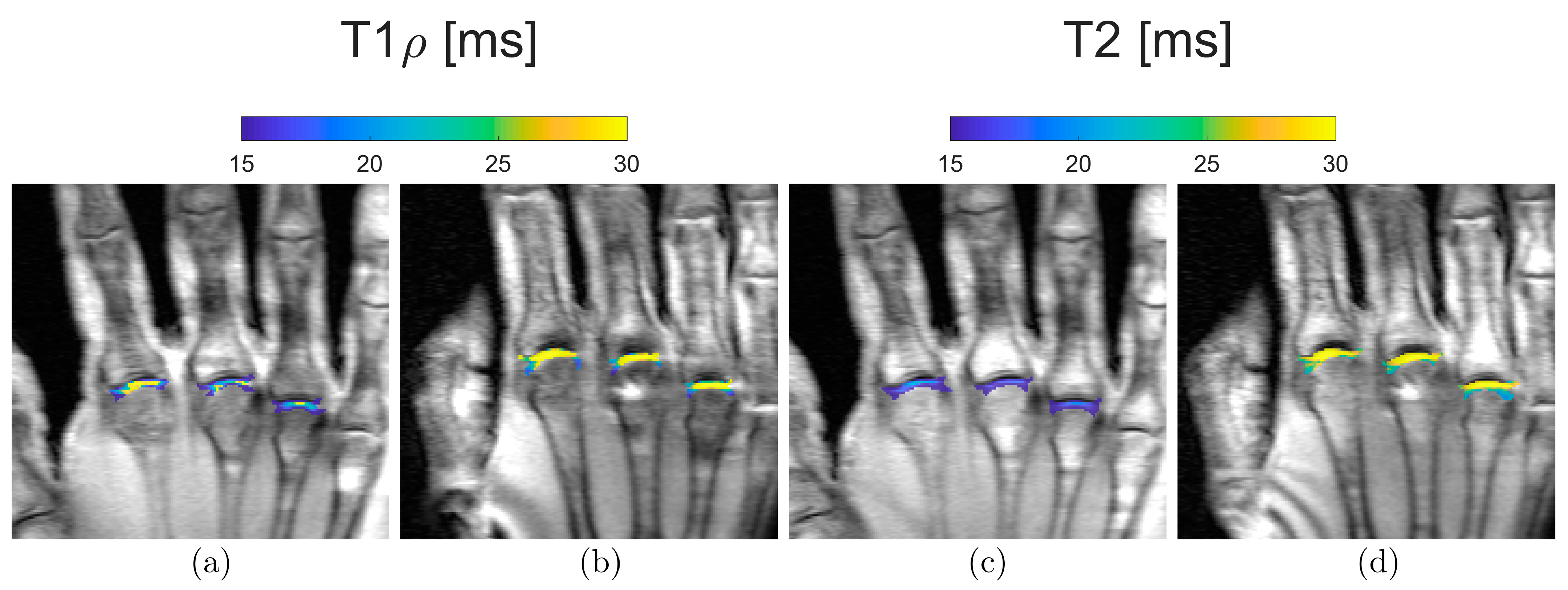 Diagnostics 13 01746 g004