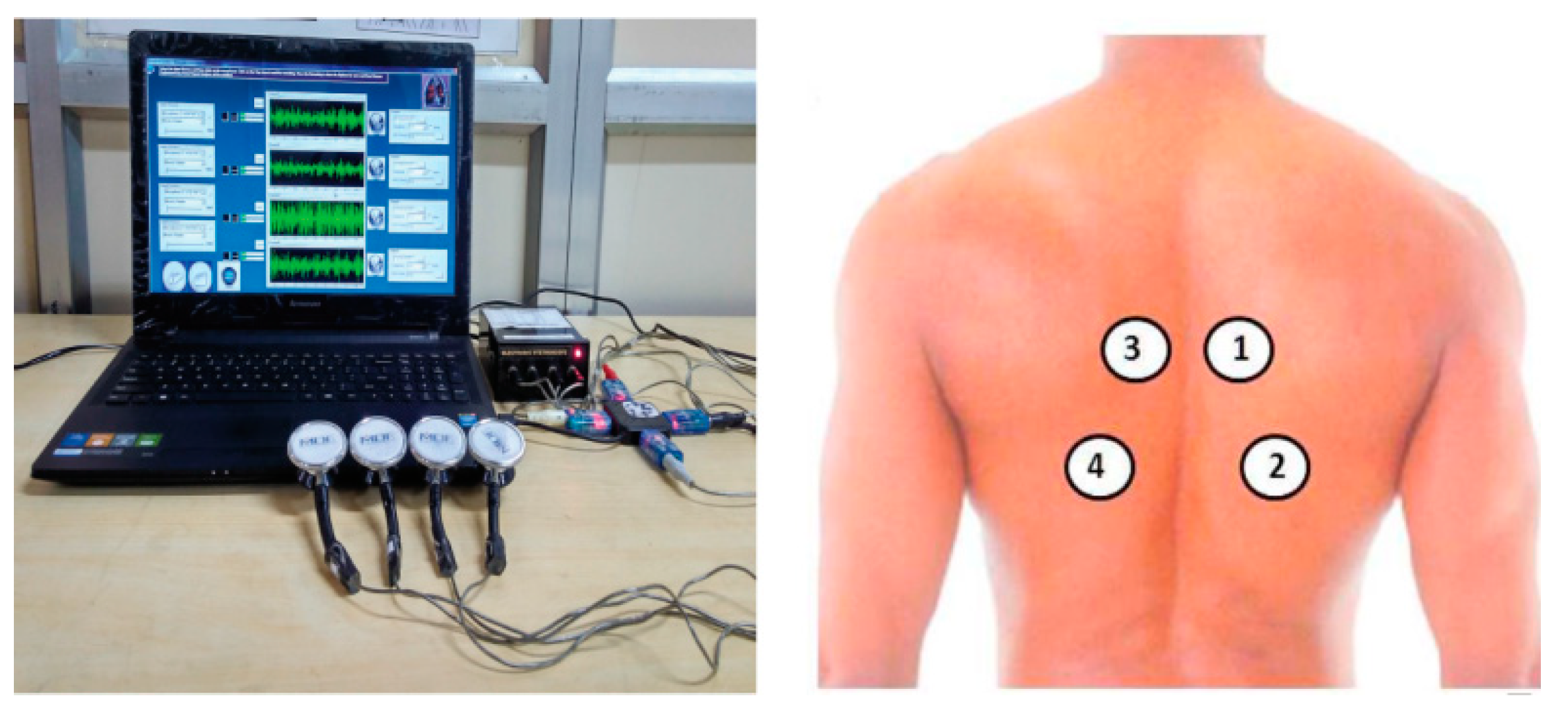 Diagnostics 13 01748 g007 Diagnostics 13 01748 g007