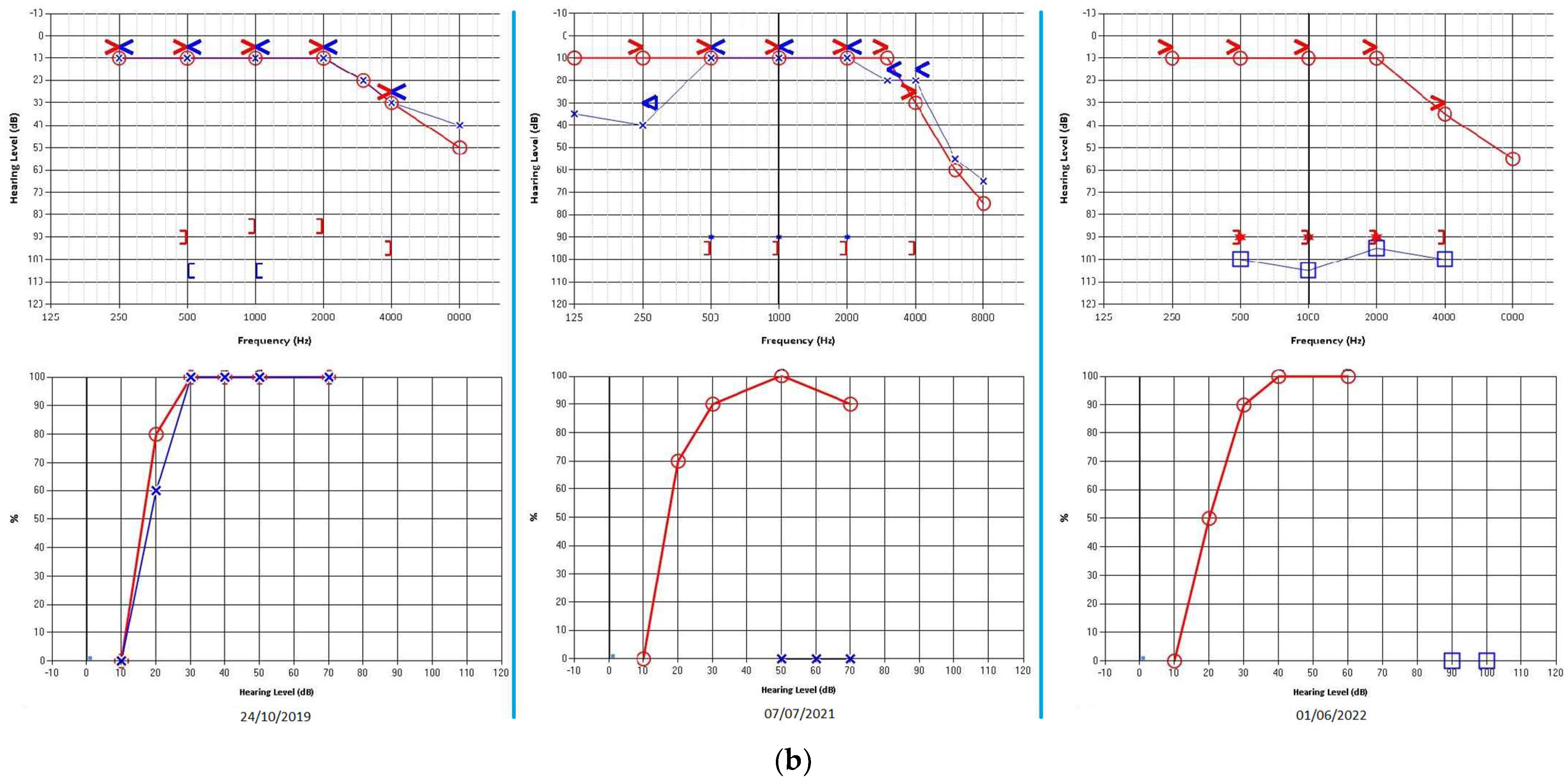 Diagnostics 13 01750 g001b Diagnostics 13 01750 g001b