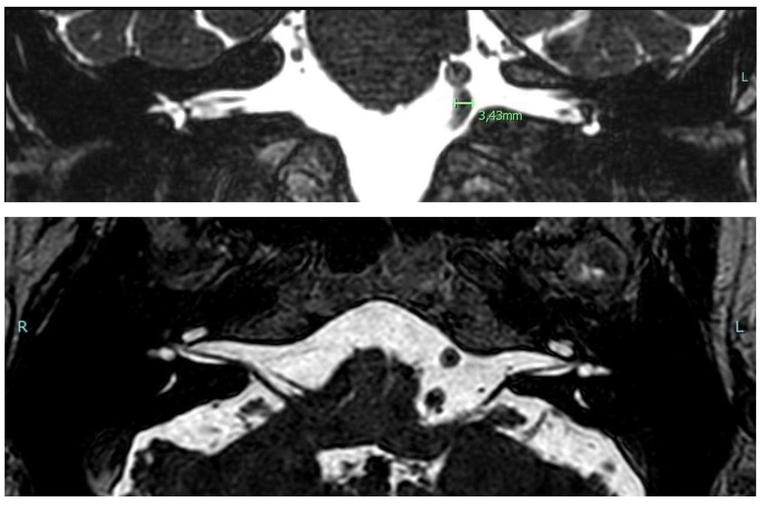Diagnostics 13 01750 g002 Diagnostics 13 01750 g002