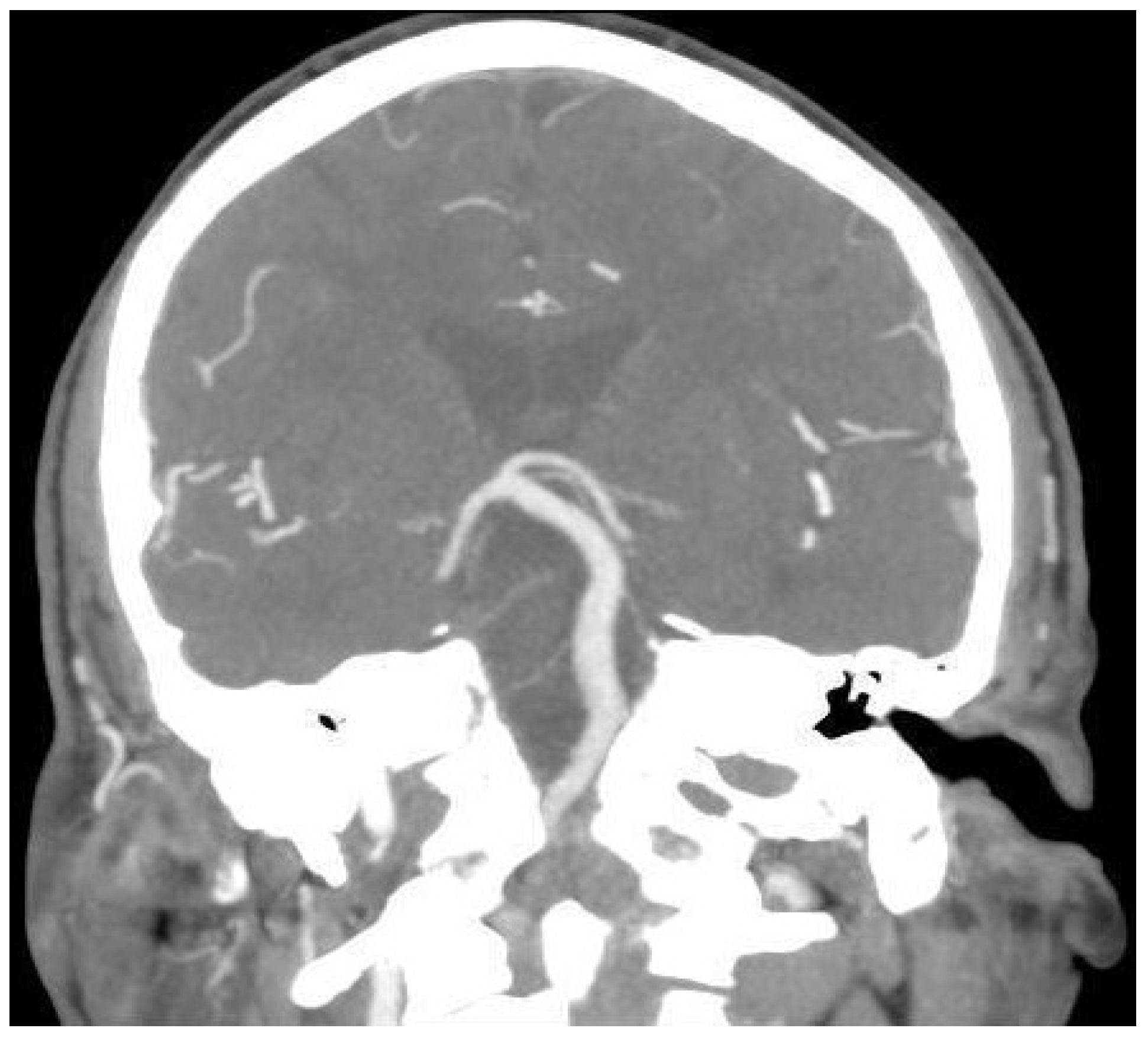 Diagnostics 13 01750 g003 Diagnostics 13 01750 g003