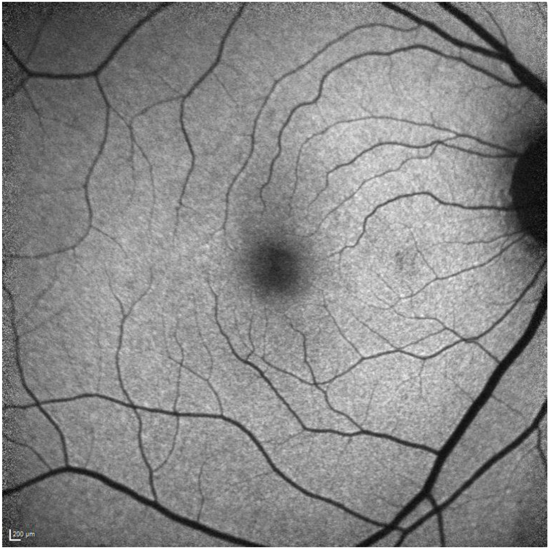 Diagnostics 13 01752 g002 Diagnostics 13 01752 g002