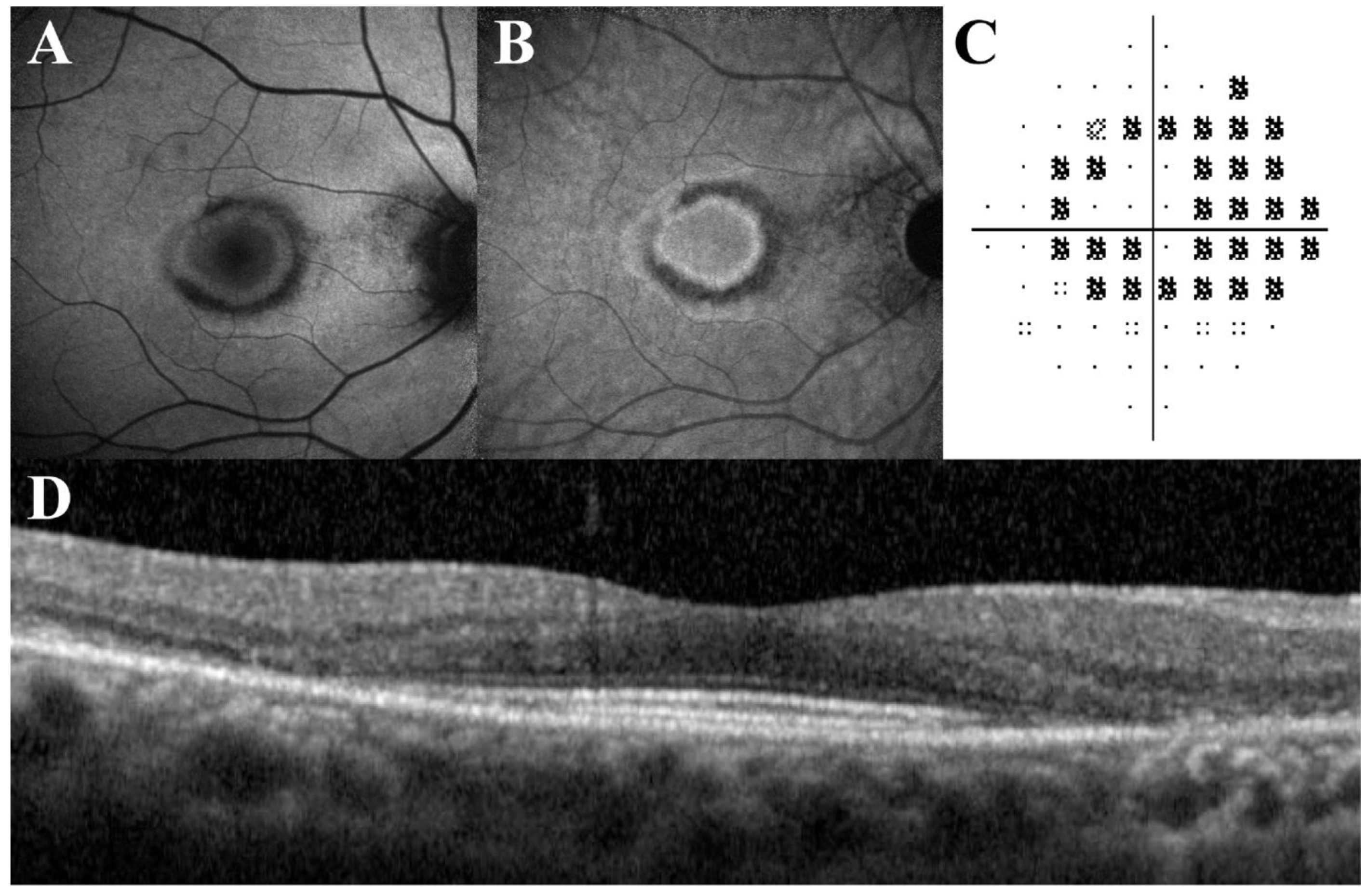 Diagnostics 13 01752 g007 Diagnostics 13 01752 g007