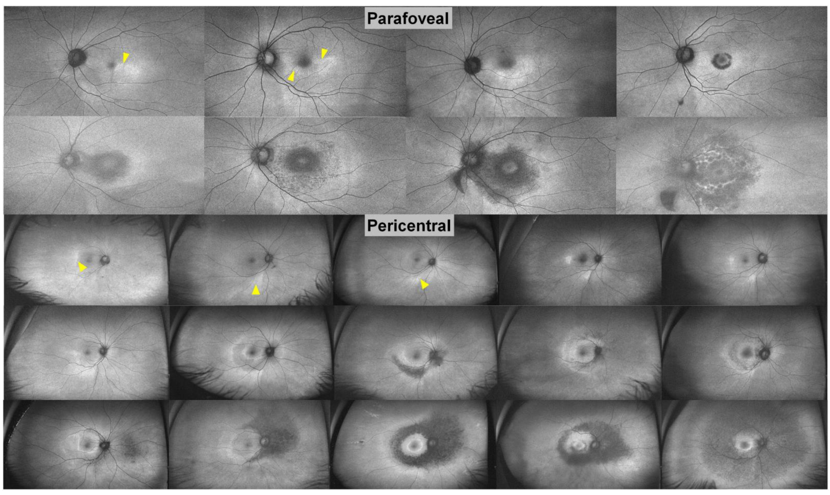 Diagnostics 13 01752 g008 Diagnostics 13 01752 g008