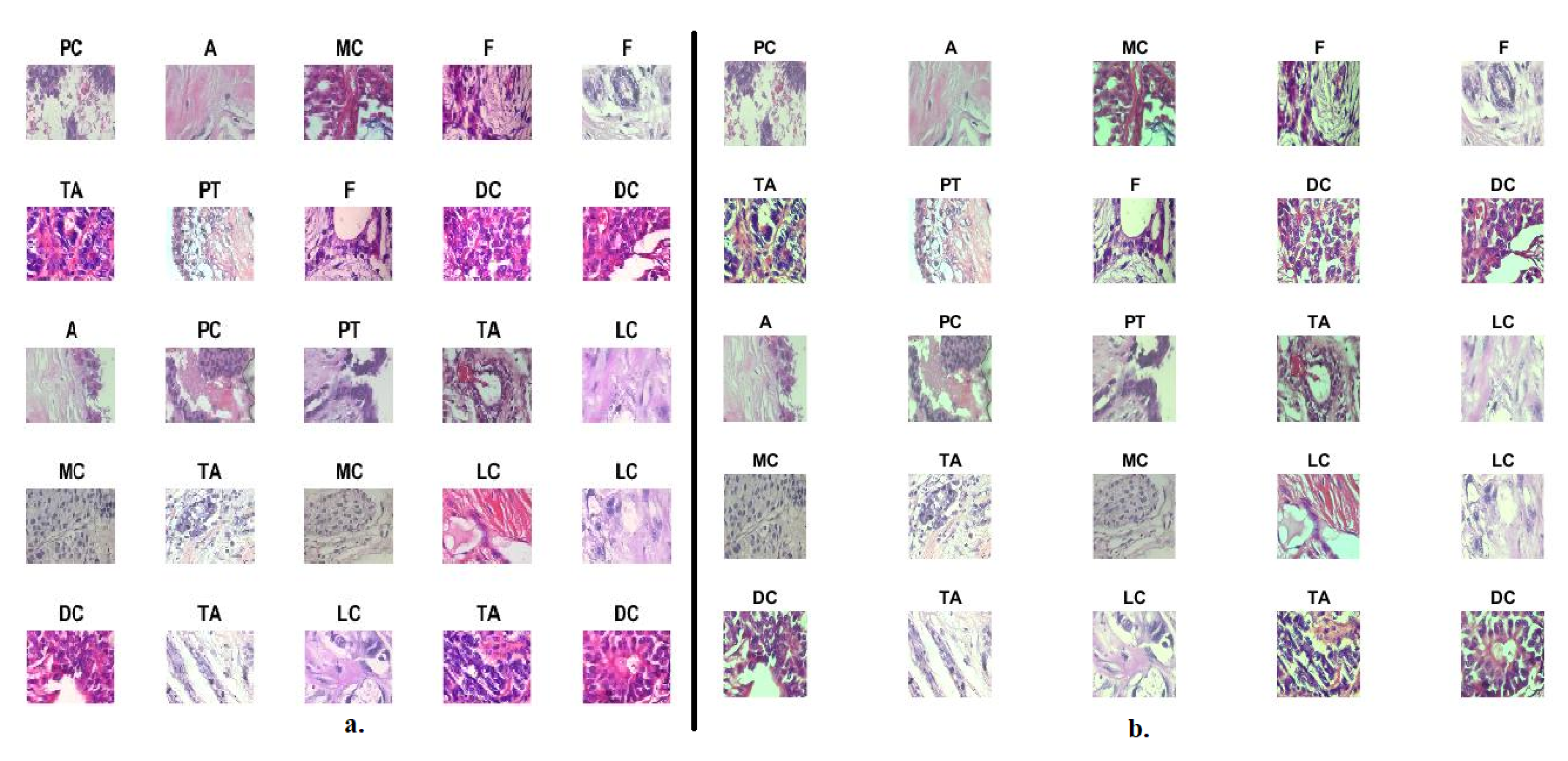 Diagnostics 13 01753 g002 550