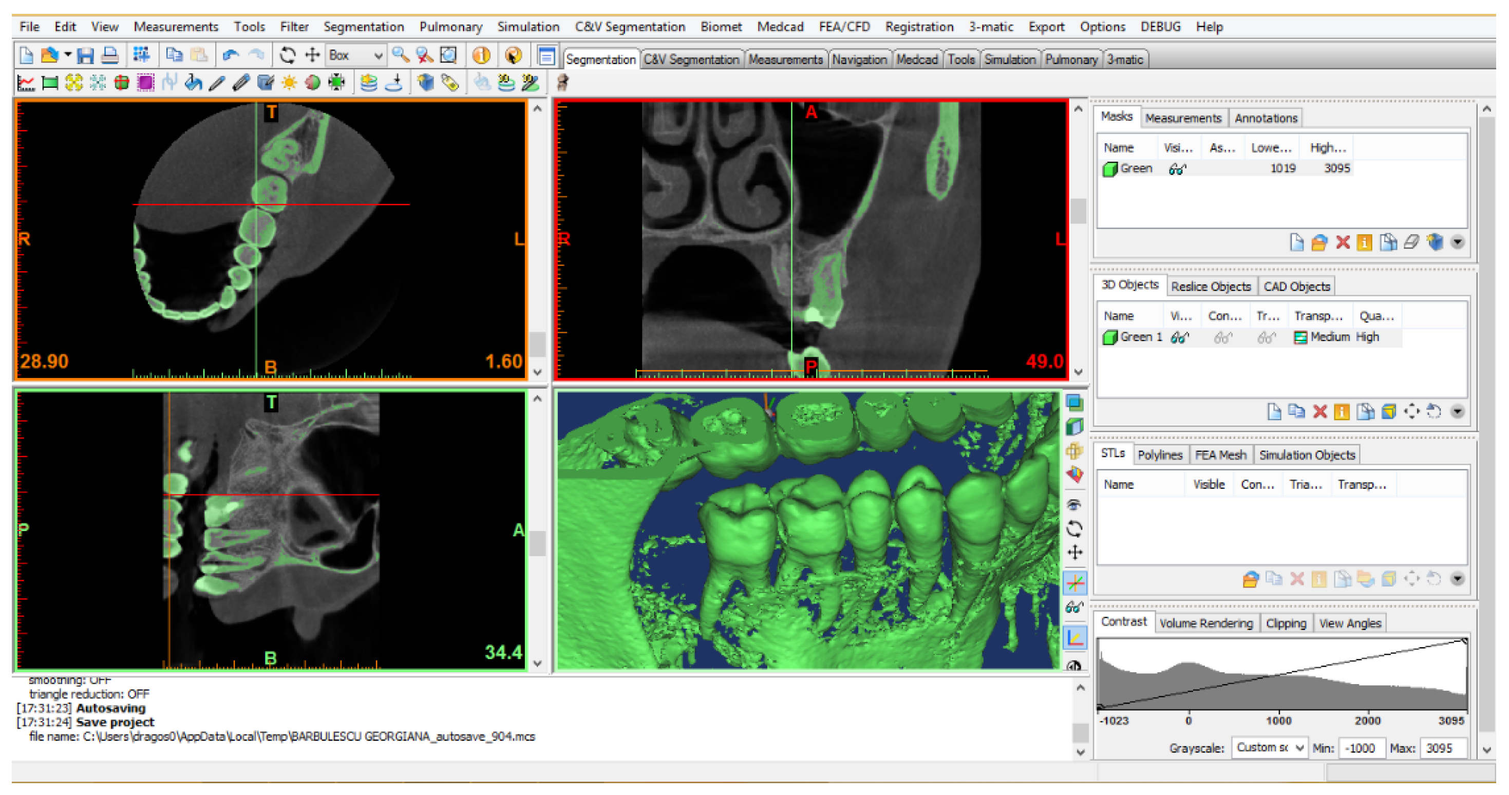 Diagnostics 13 01757 g001 Diagnostics 13 01757 g001