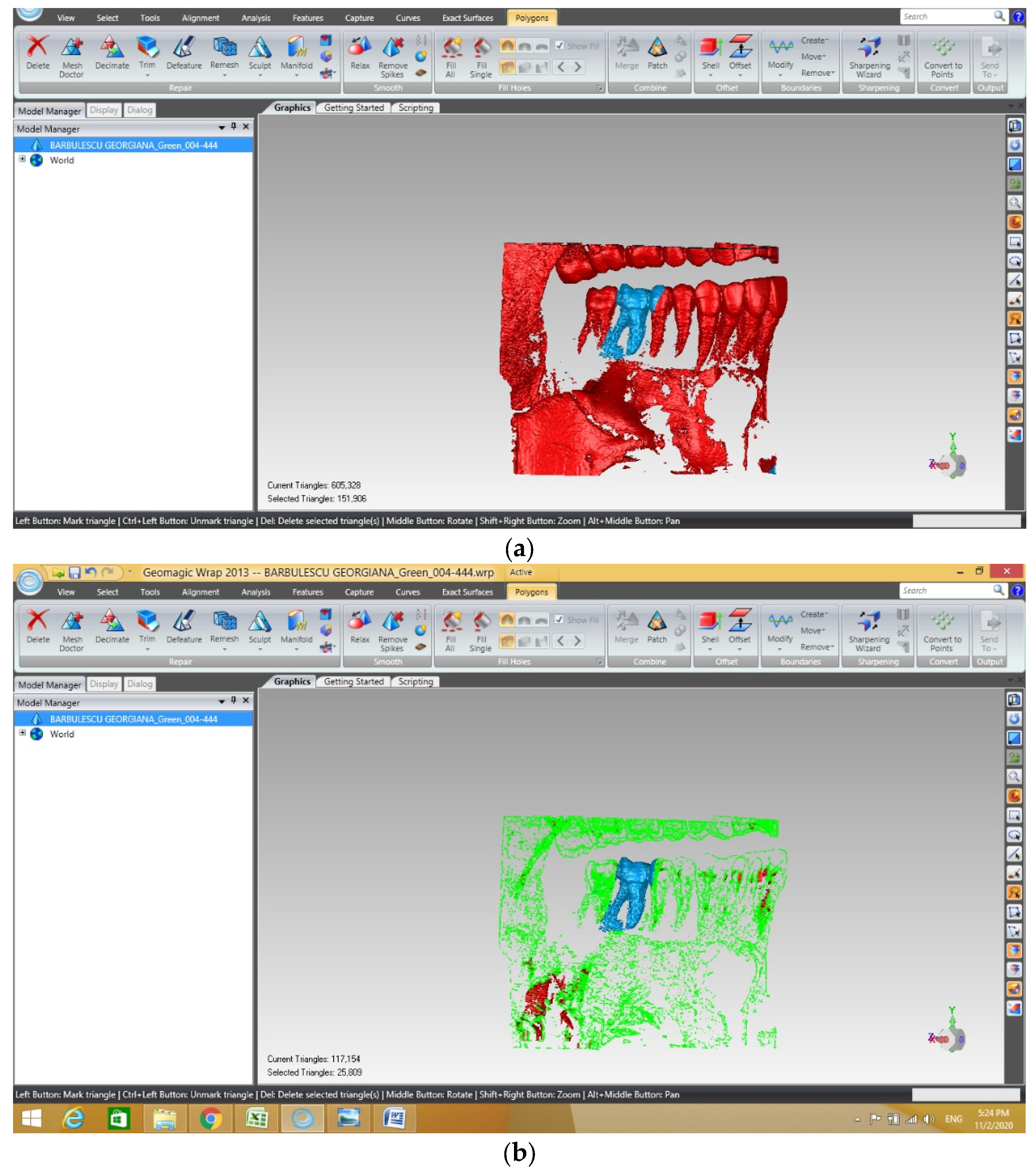 Diagnostics 13 01757 g002 Diagnostics 13 01757 g002