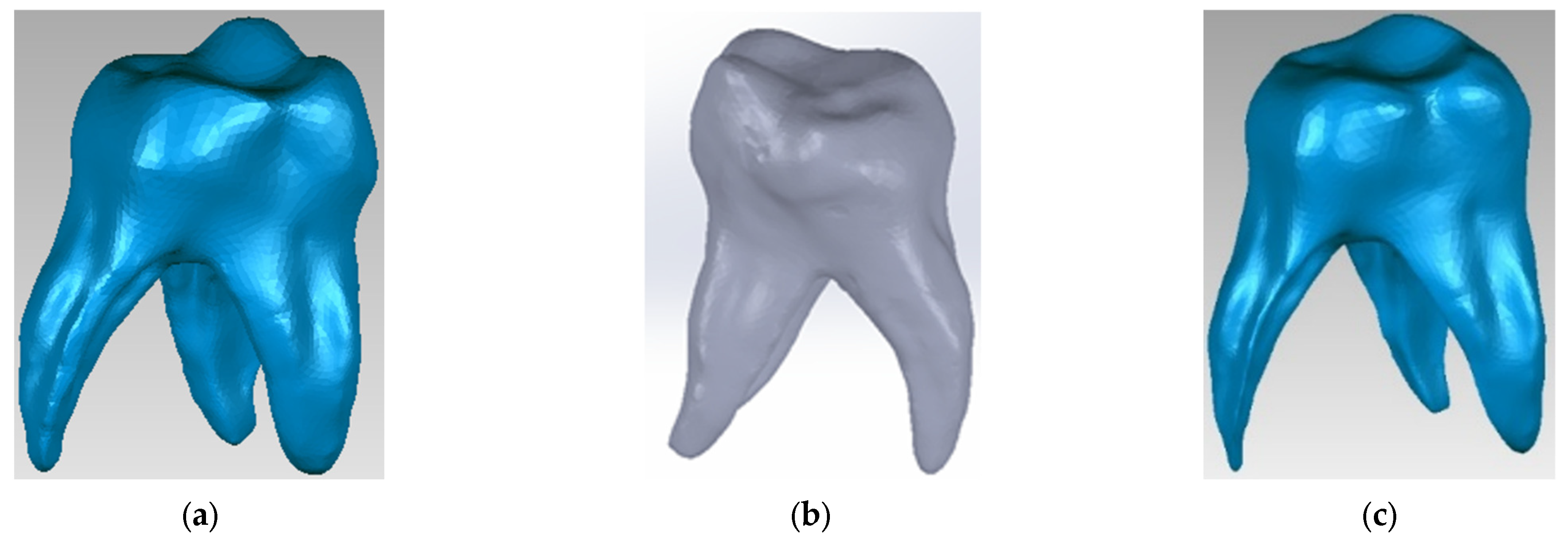 Diagnostics 13 01757 g003 Diagnostics 13 01757 g003