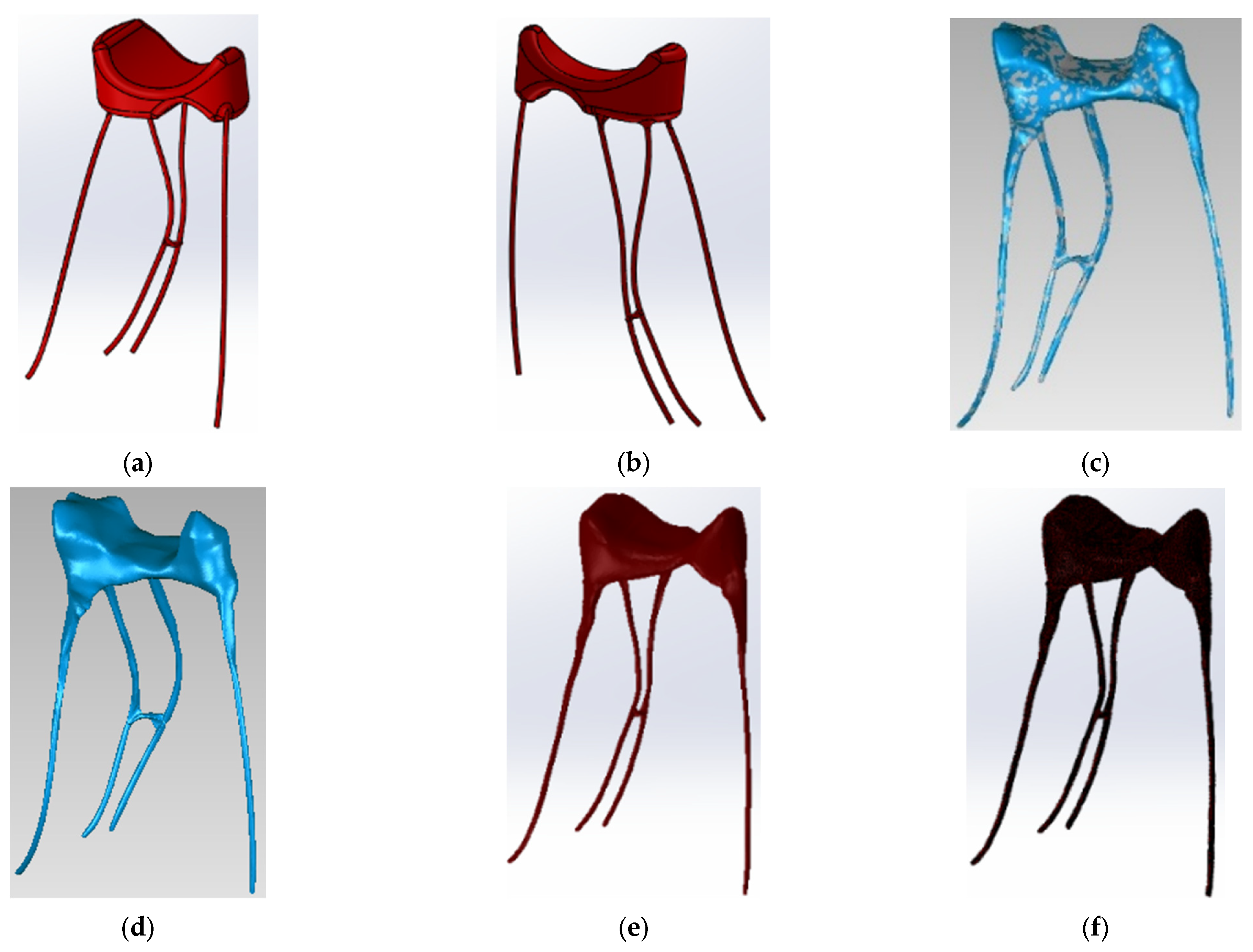Diagnostics 13 01757 g004 Diagnostics 13 01757 g004