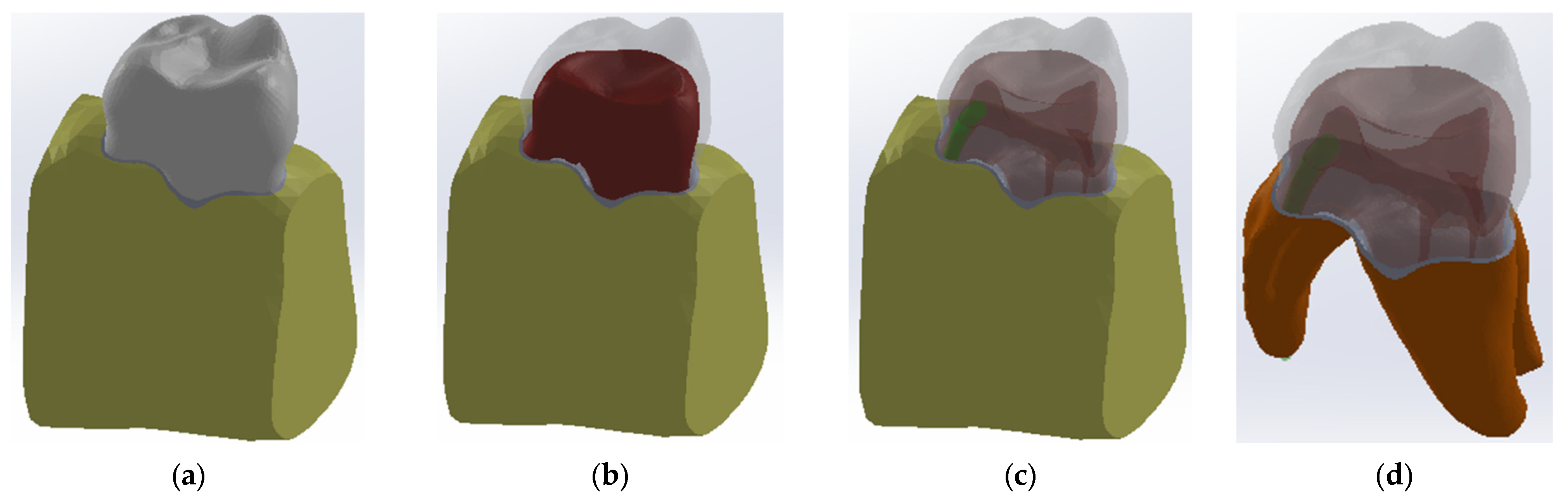 Diagnostics 13 01757 g007 Diagnostics 13 01757 g007