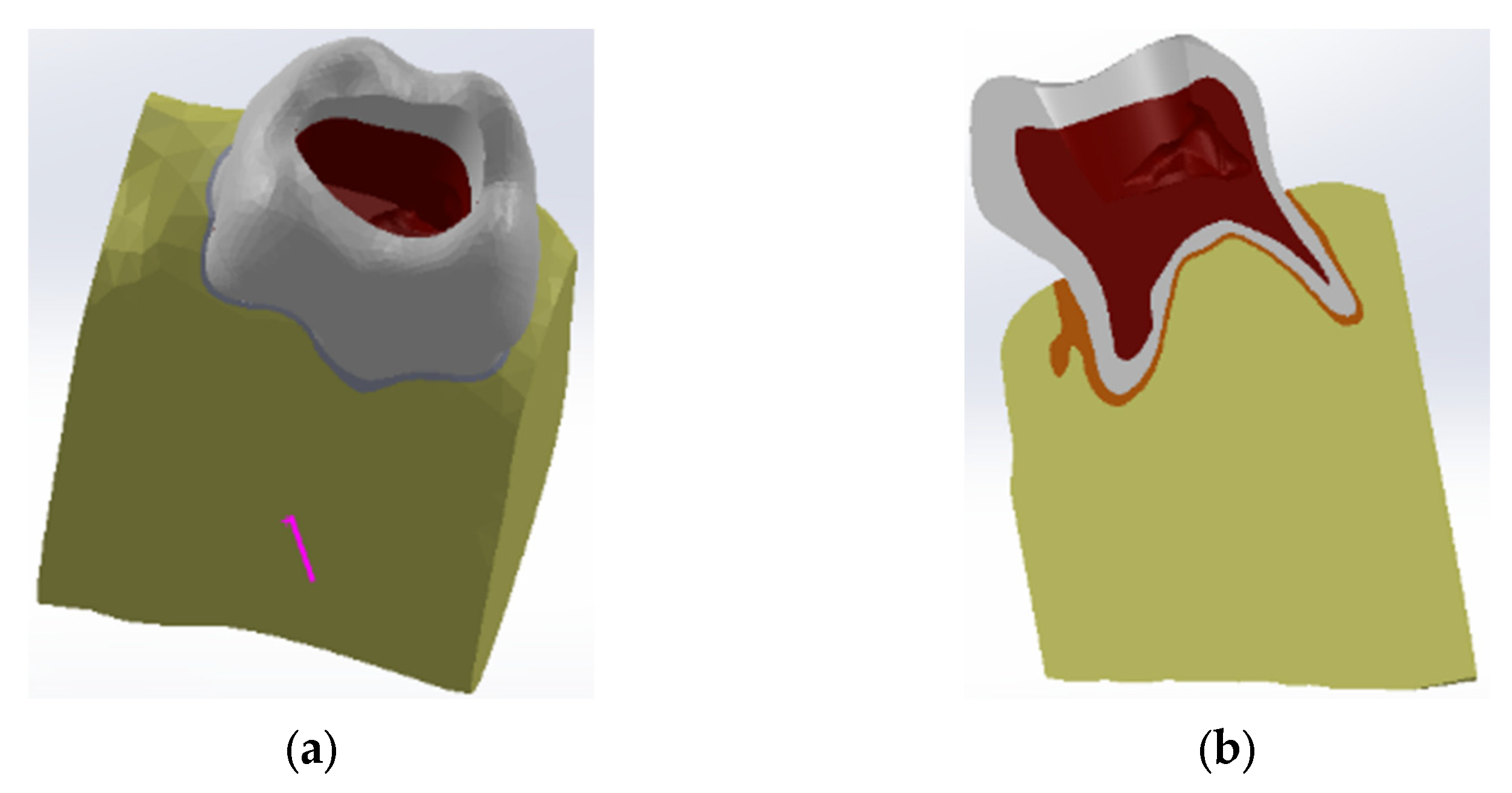 Diagnostics 13 01757 g008 Diagnostics 13 01757 g008
