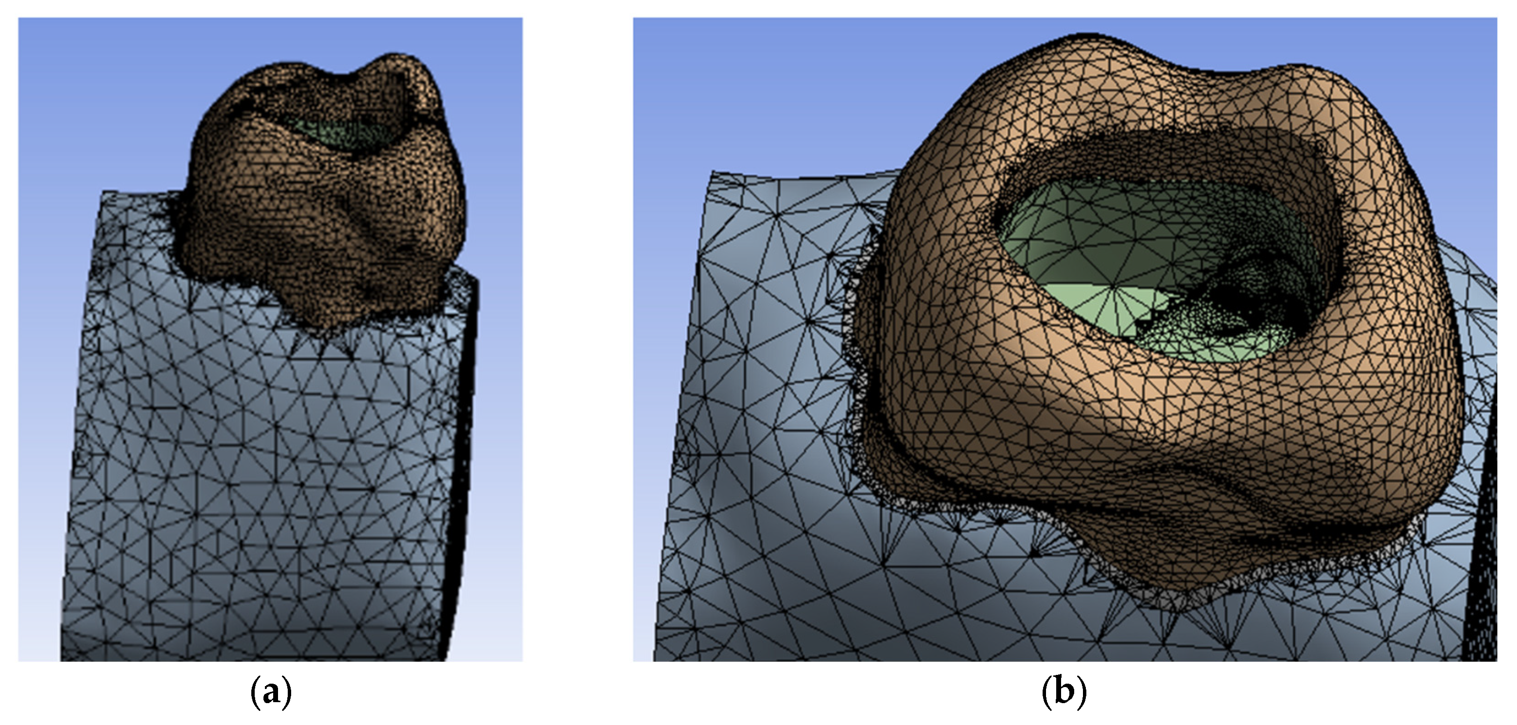Diagnostics 13 01757 g011 Diagnostics 13 01757 g011