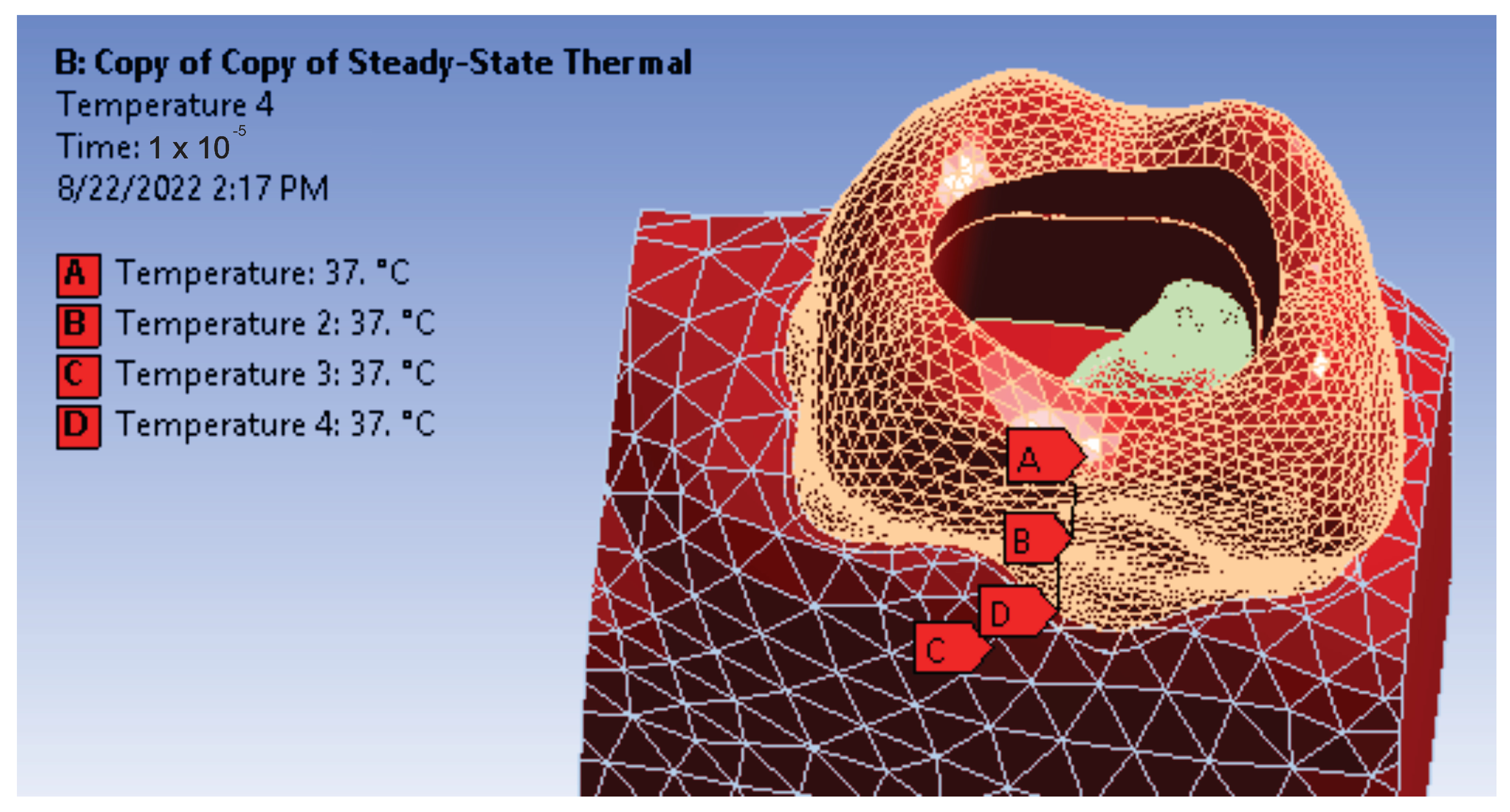 Diagnostics 13 01757 g012 Diagnostics 13 01757 g012
